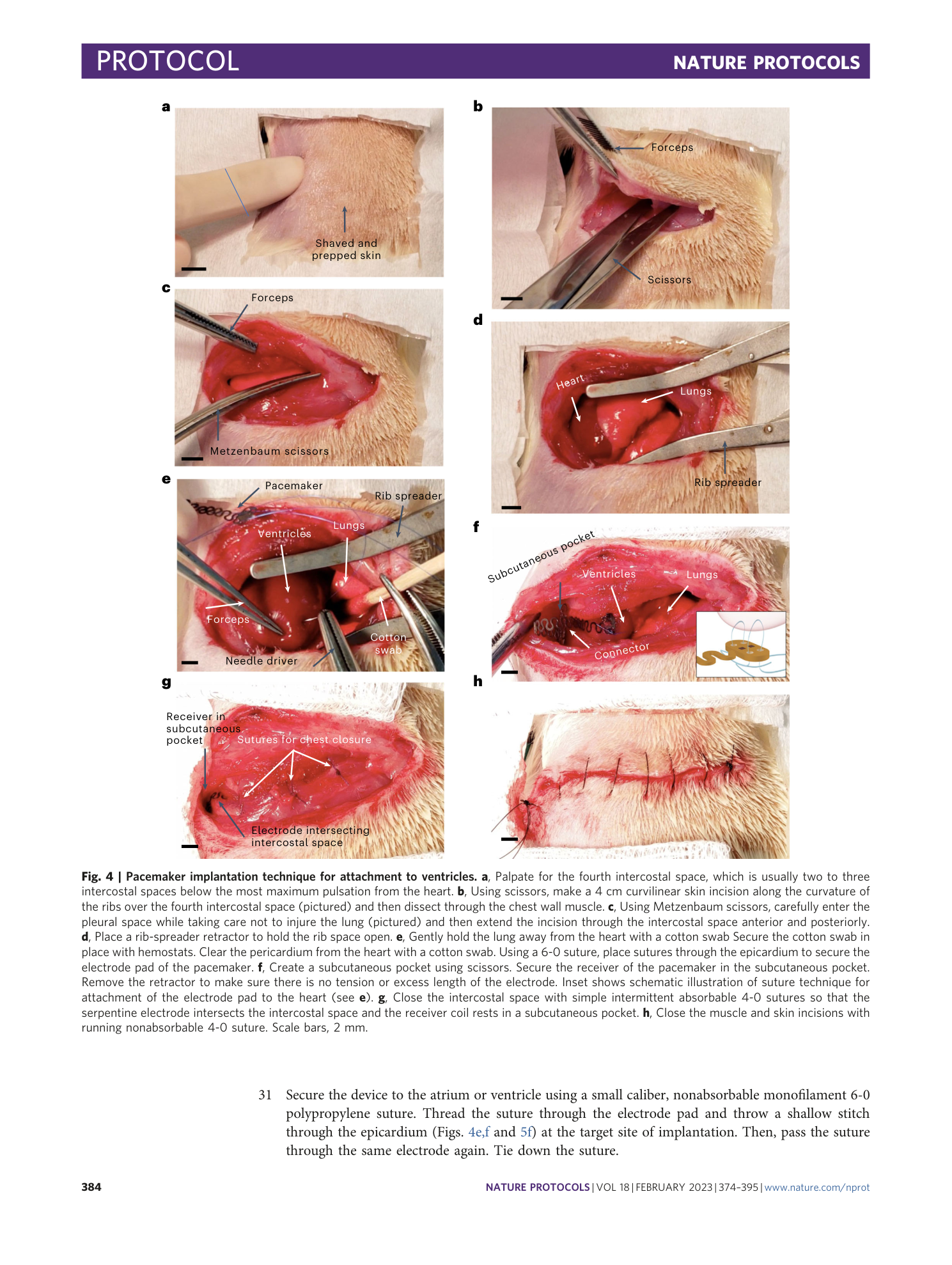 page-11