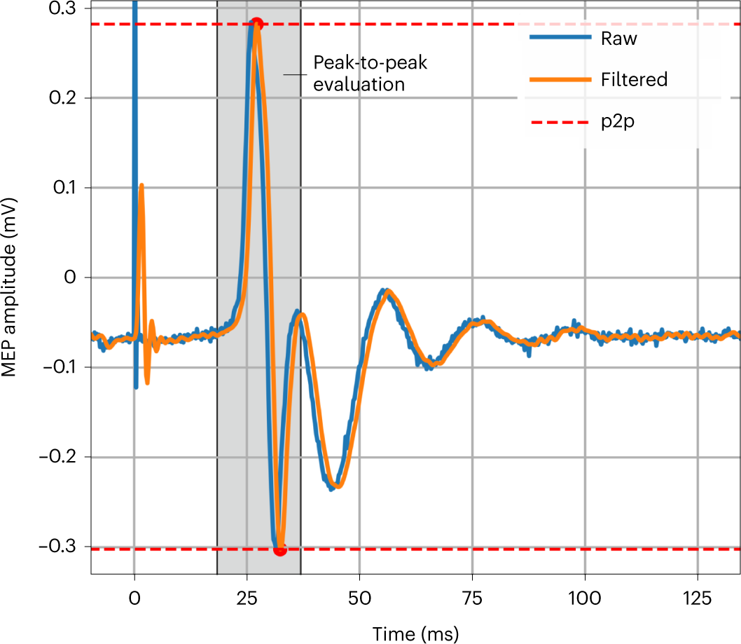 Fig. 14: Postprocessing of recorded EMG data.