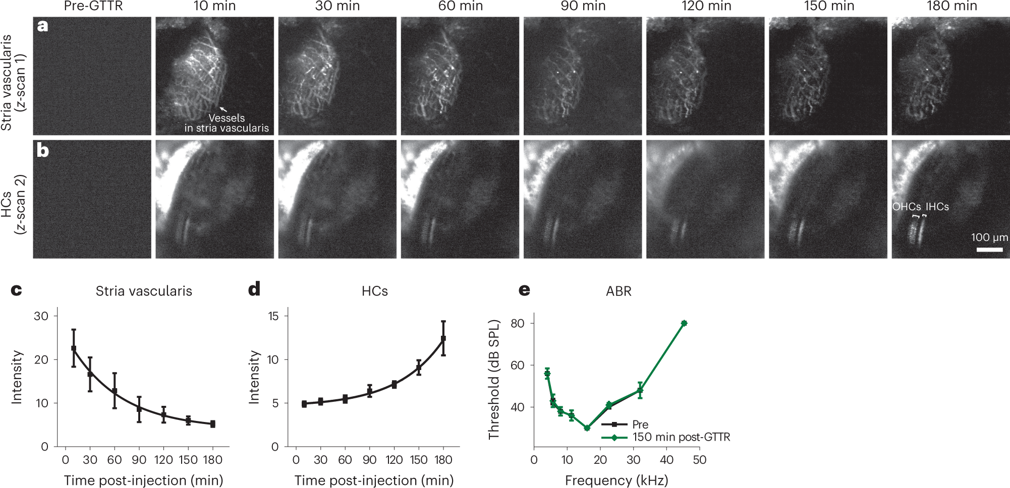 Fig. 9: In vivo time-lapse images of GTTR.