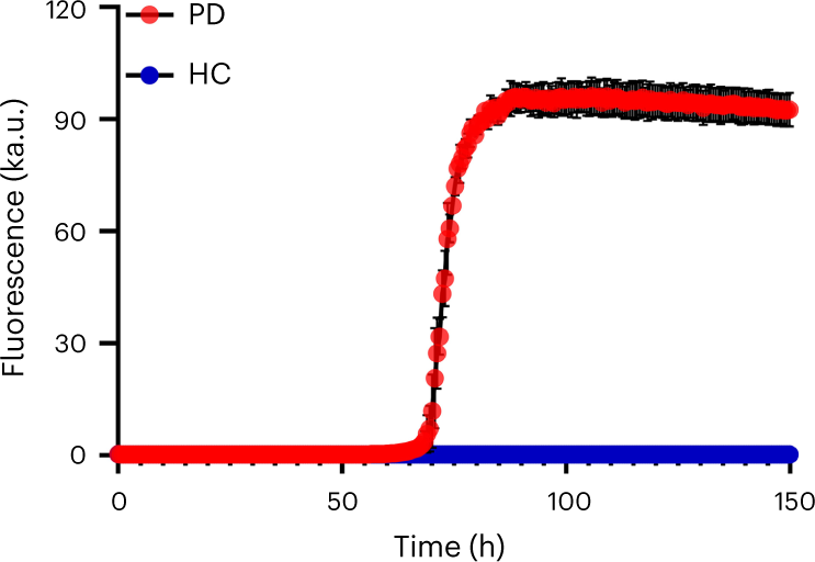 Fig. 4: Performance of optimized αSyn-SAA for the detection of αSyn aggregates in CSF samples of patients with PD.