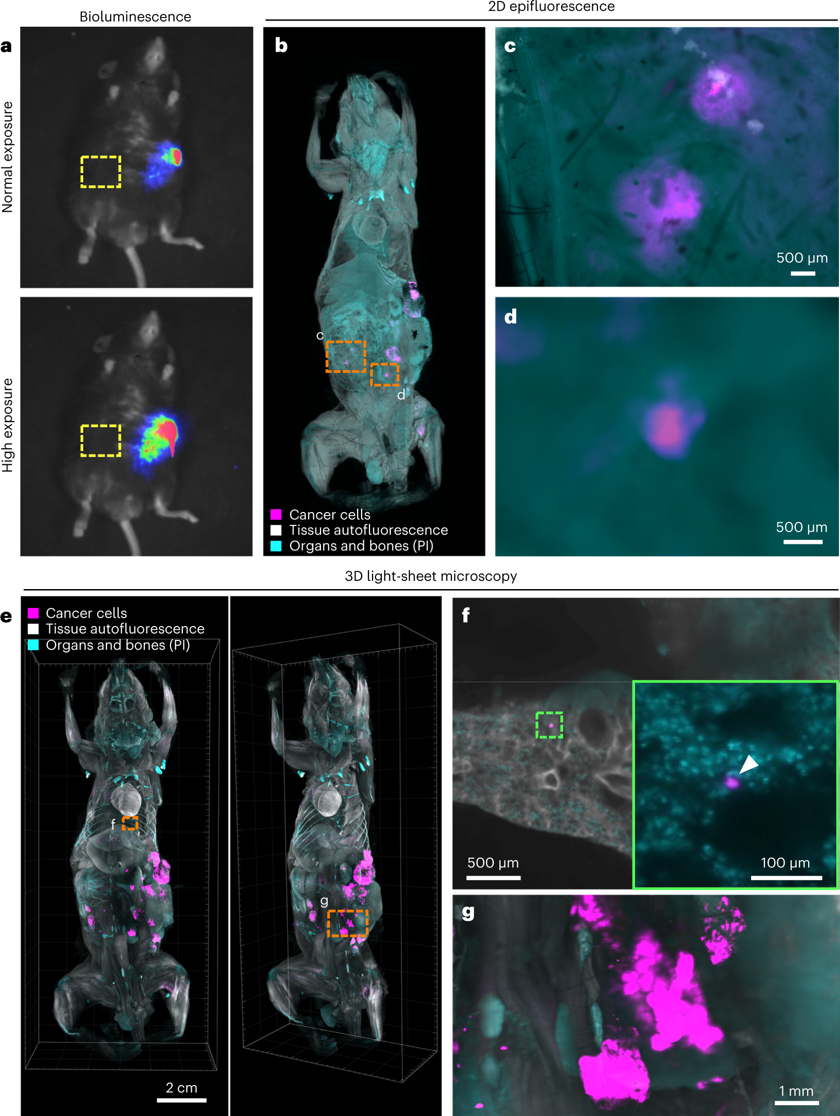 Fig. 2: vDISCO imaging of a mouse with syngeneic pancreatic cancer.