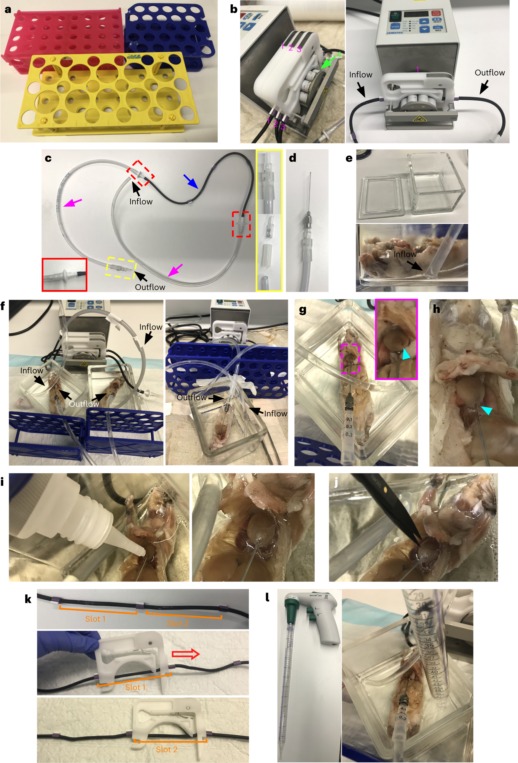Fig. 3: Whole-body active-vDISCO setup.