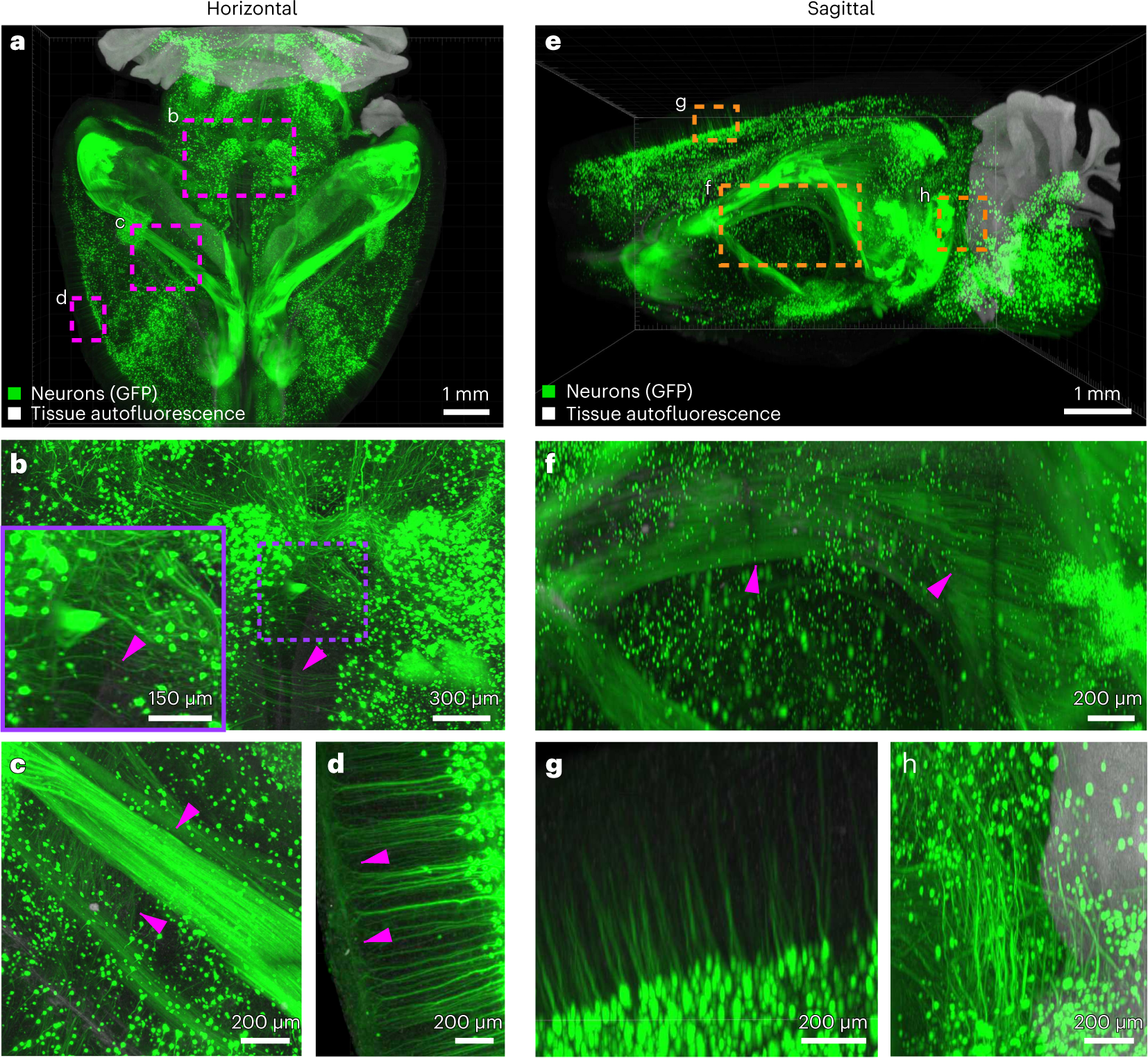Fig. 5: vDISCO processed Thy1-GFPM brain imaged with Z.1 light-sheet microscope.