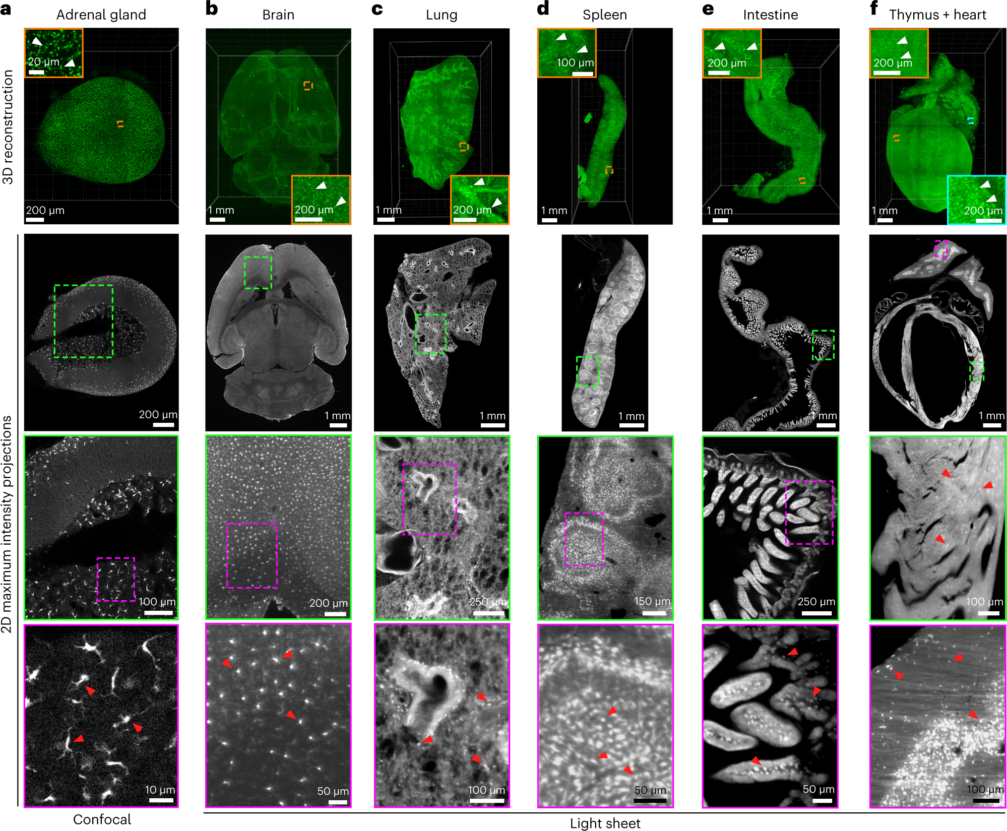 Fig. 6: Passive-vDISCO on dissected organs imaged with confocal and light-sheet microscopy.