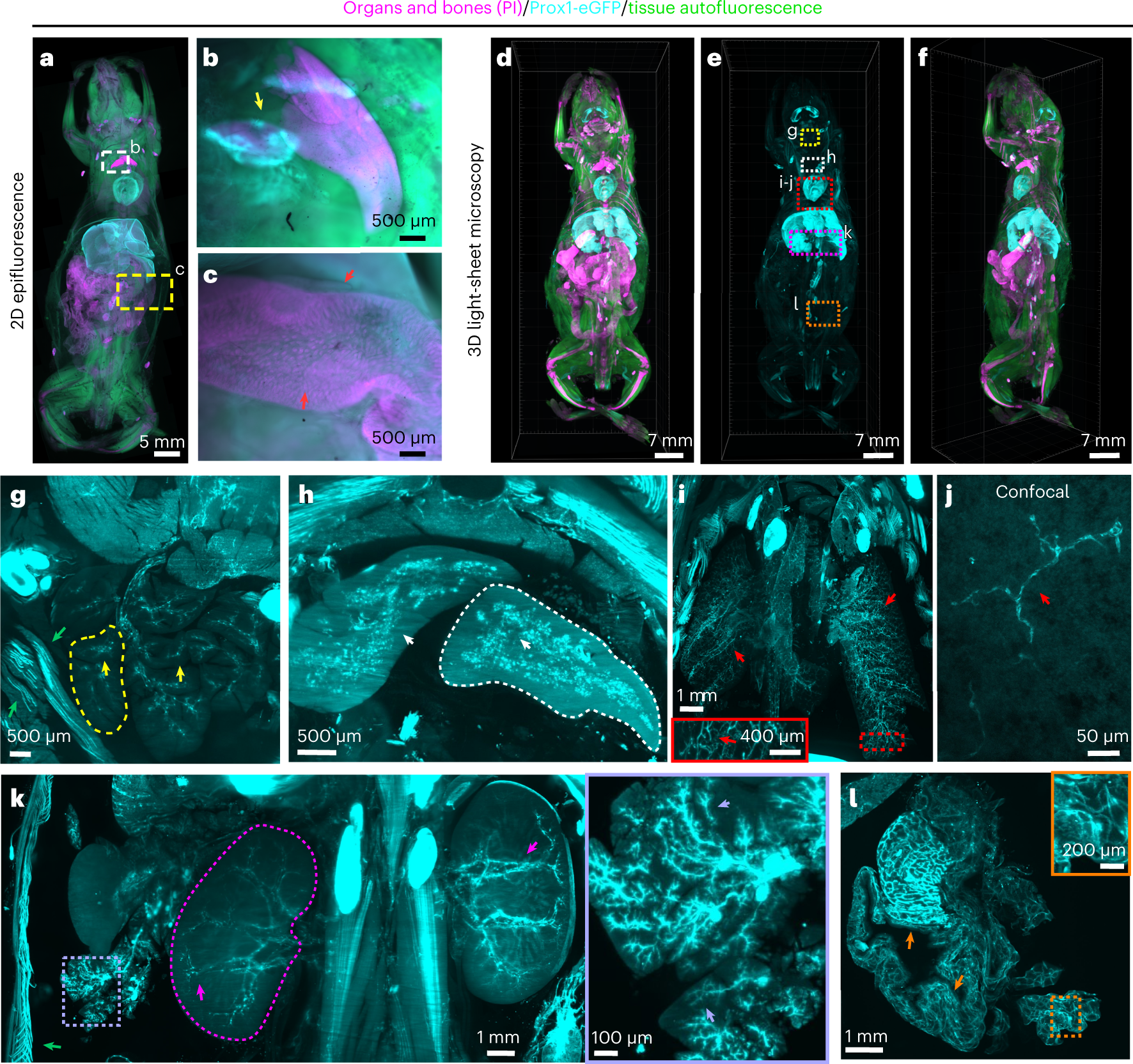 Fig. 8: Prox1-EGFP whole-body scan taken with epifluorescence, light-sheet and confocal microscopy.