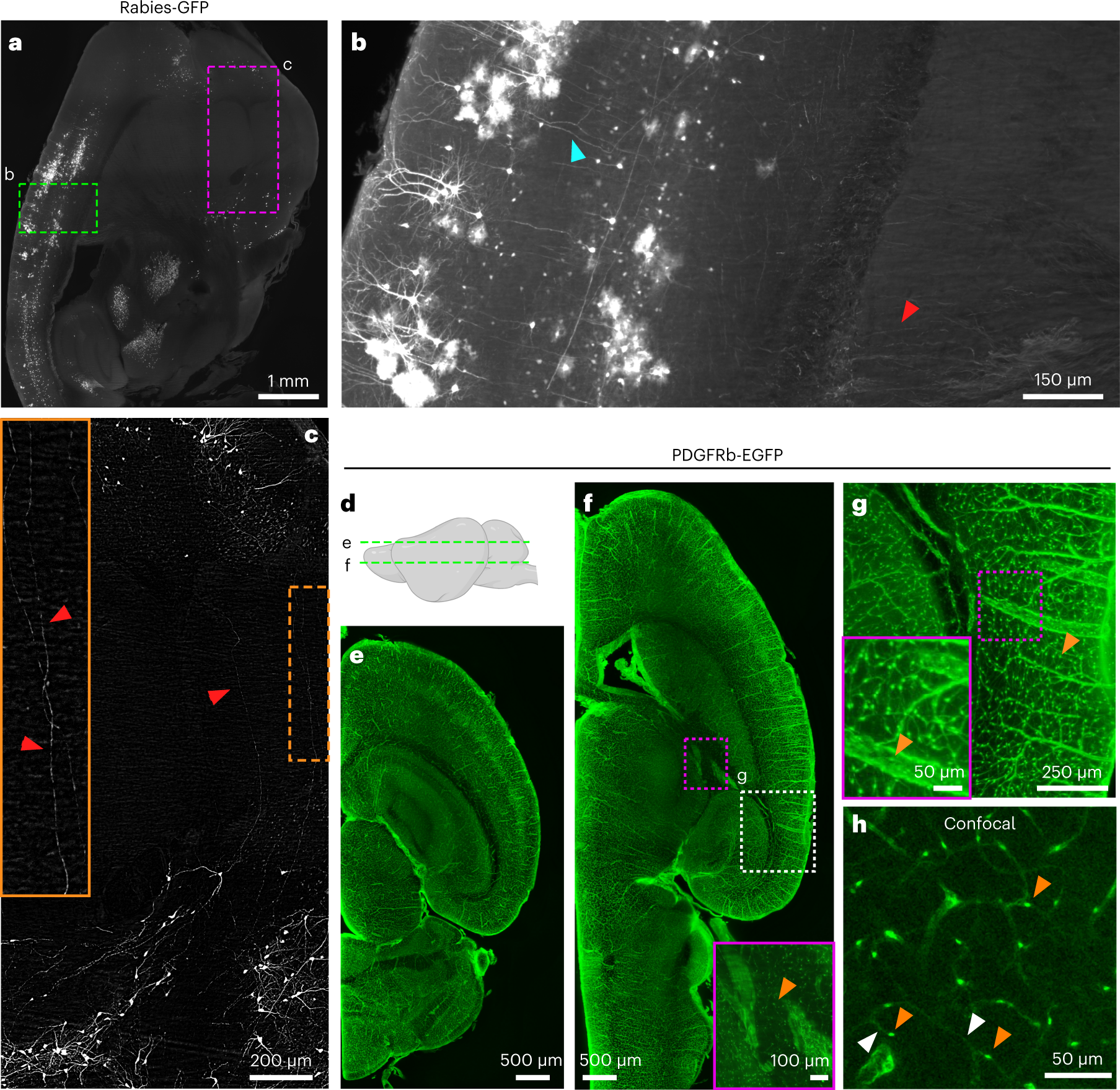 Fig. 9: Virus tracing and pericytes in the brain processed by vDISCO.