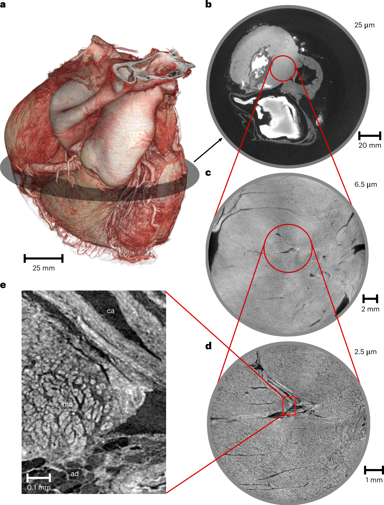 Fig. 2: HiP-CT images of an intact human heart.