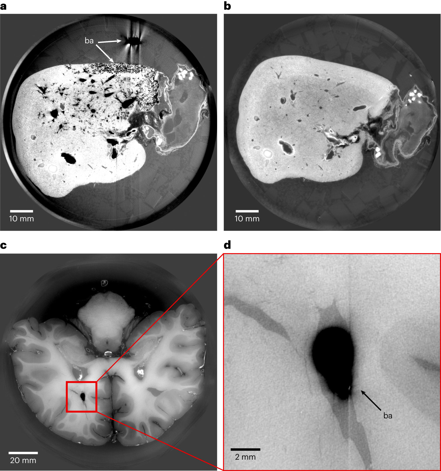 Fig. 3: Example of bubble artifacts.