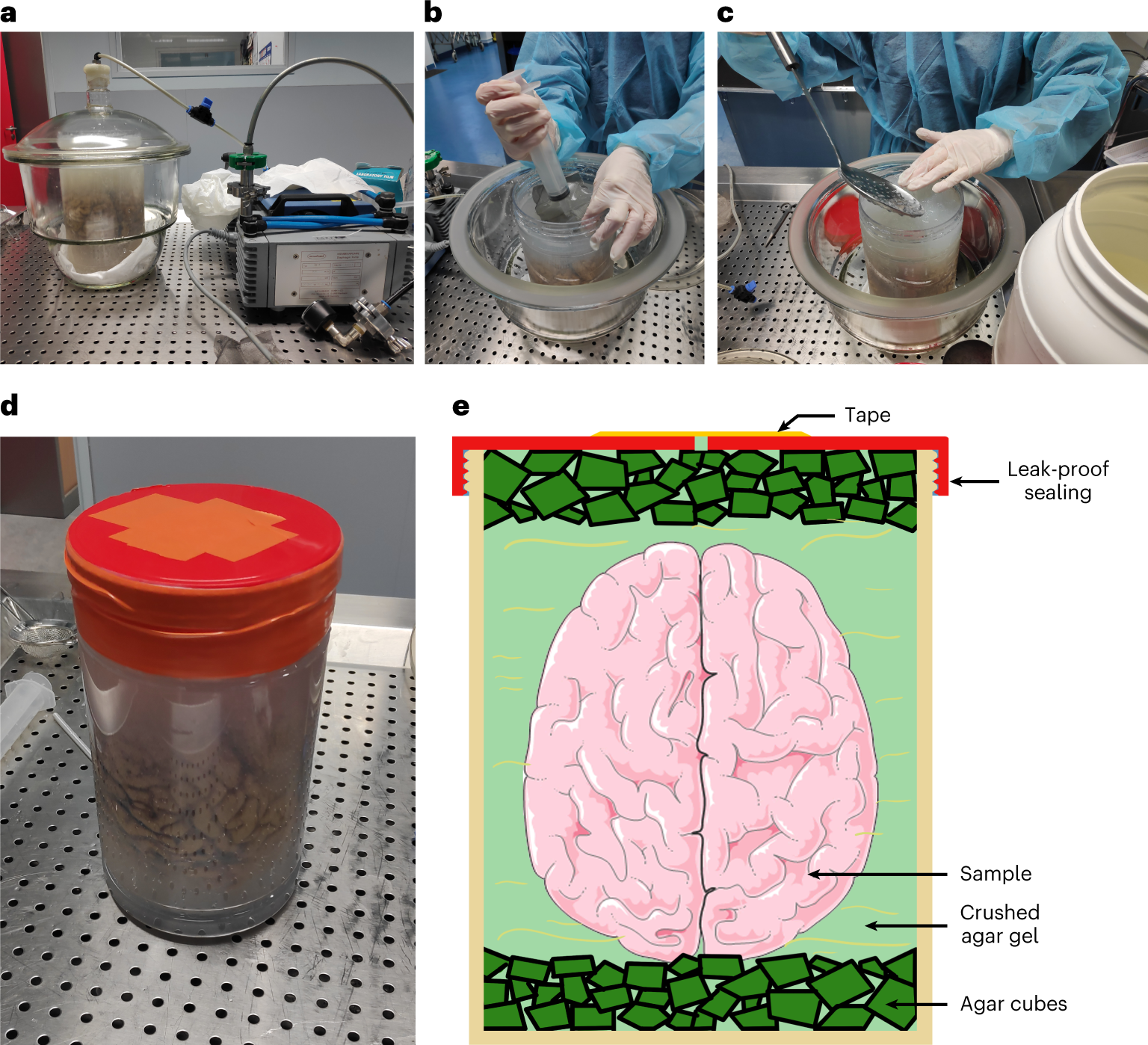 Fig. 4: Procedures for organ mounting.