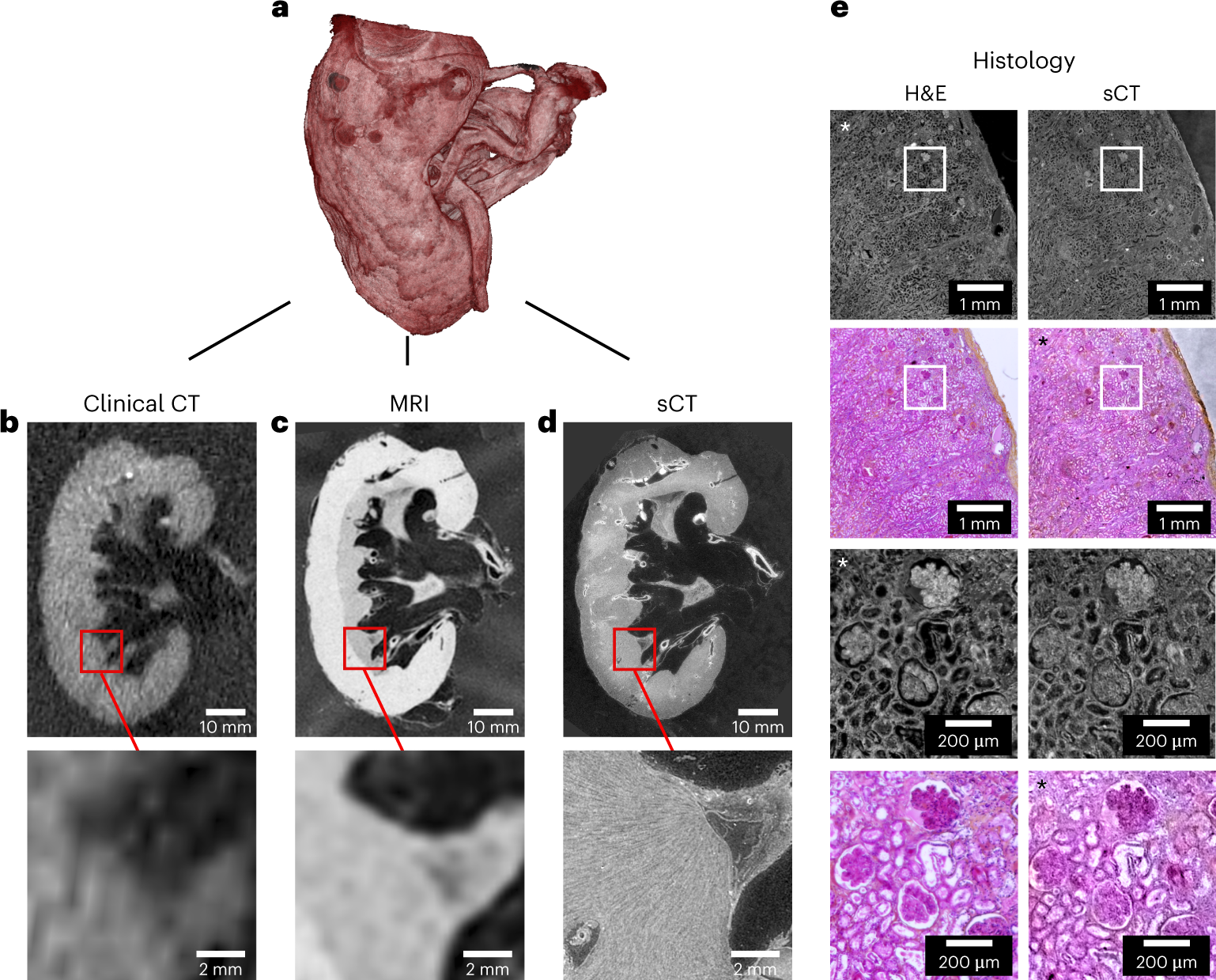 Fig. 5: Visualization of an intact human kidney mounted in 70% ethanol crushed agar gel with clinical CT, MRI, sCT and histology.