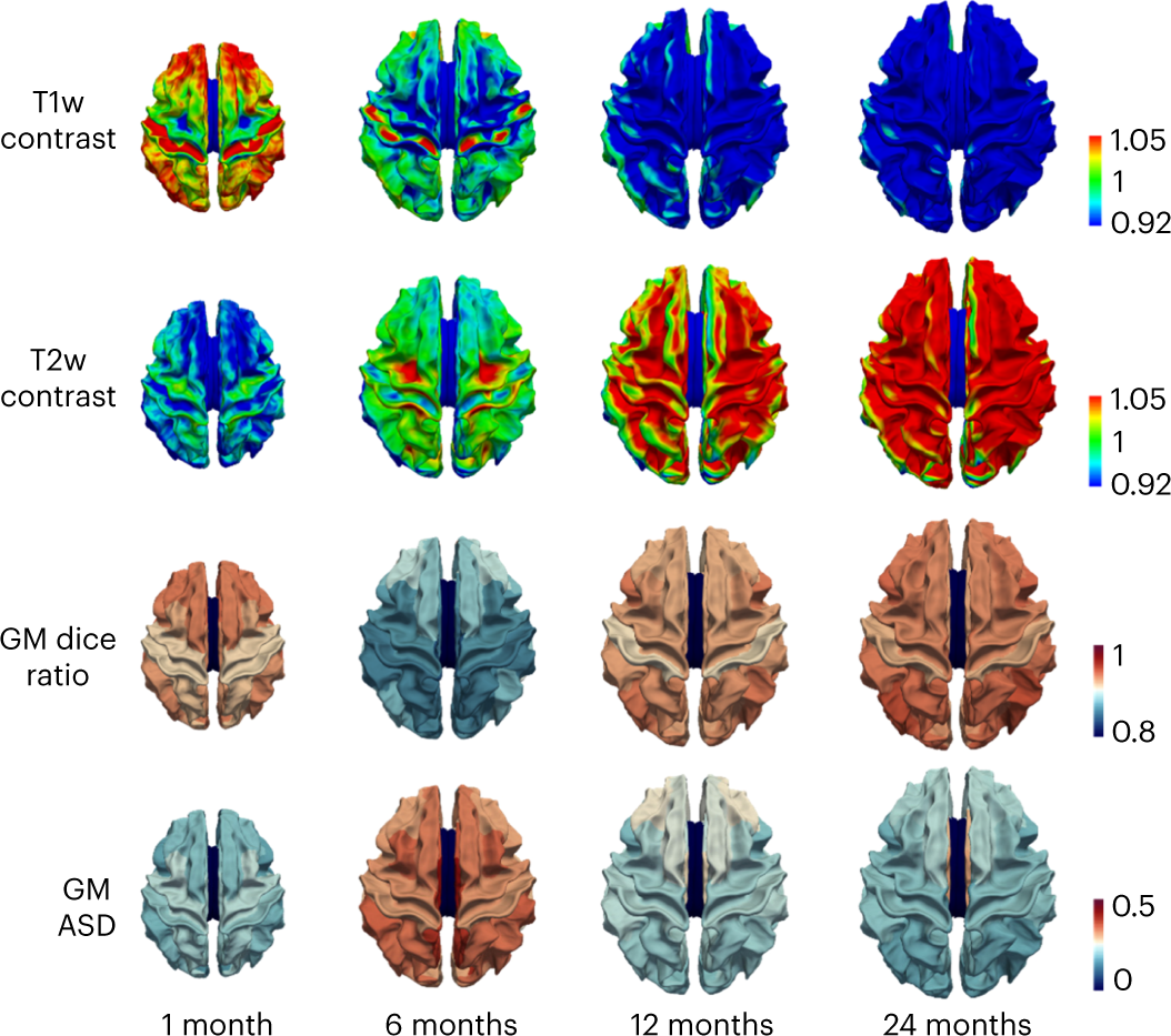 Fig. 10: The tissue contrast map and the quantitative comparison of segmentation performance in different cortical regions at different ages.