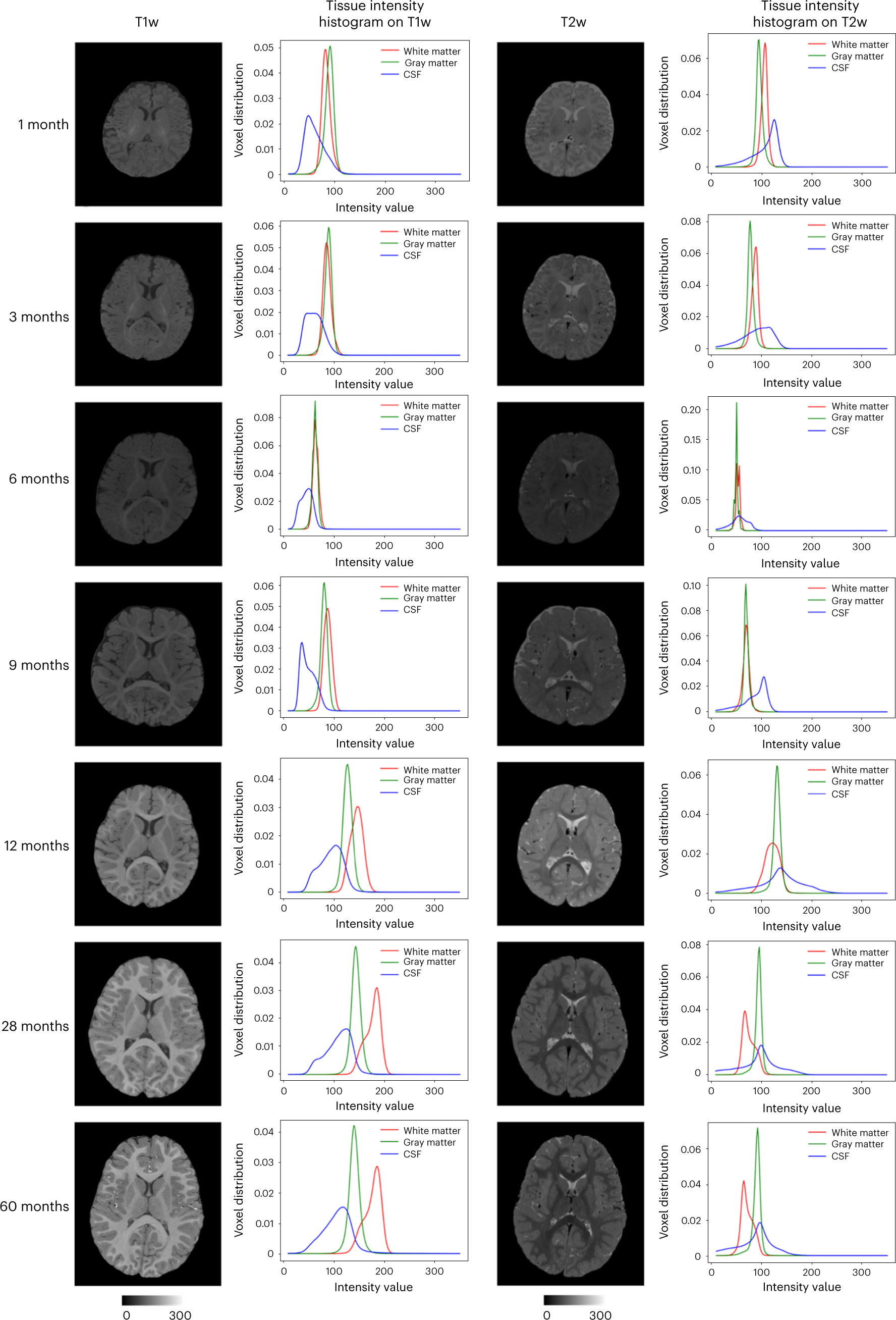 Fig. 1: Typical T1w and T2w infant brain MR images.