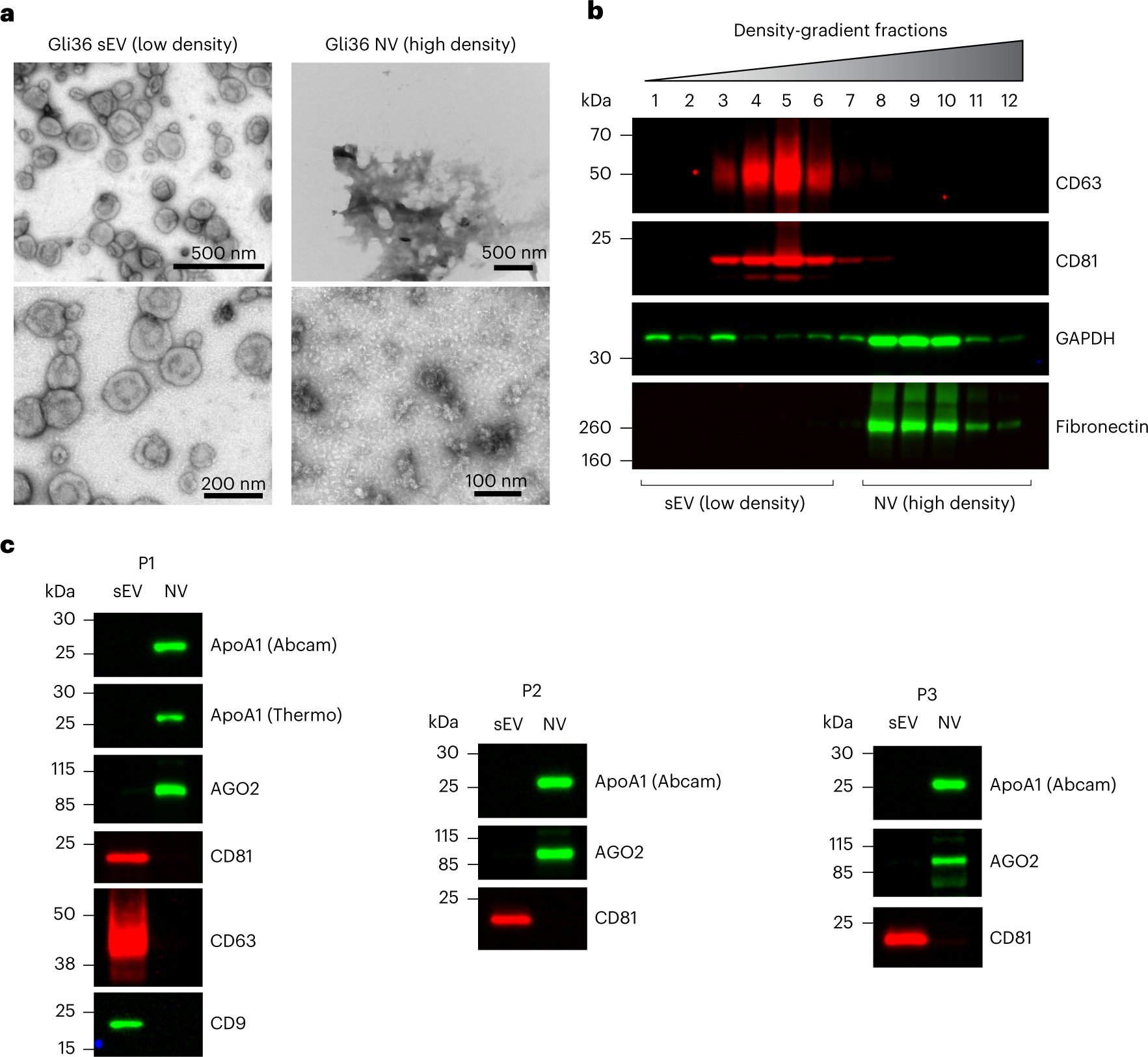 Fig. 6: High-resolution density-gradient fractionation separates sEVs from NV components.