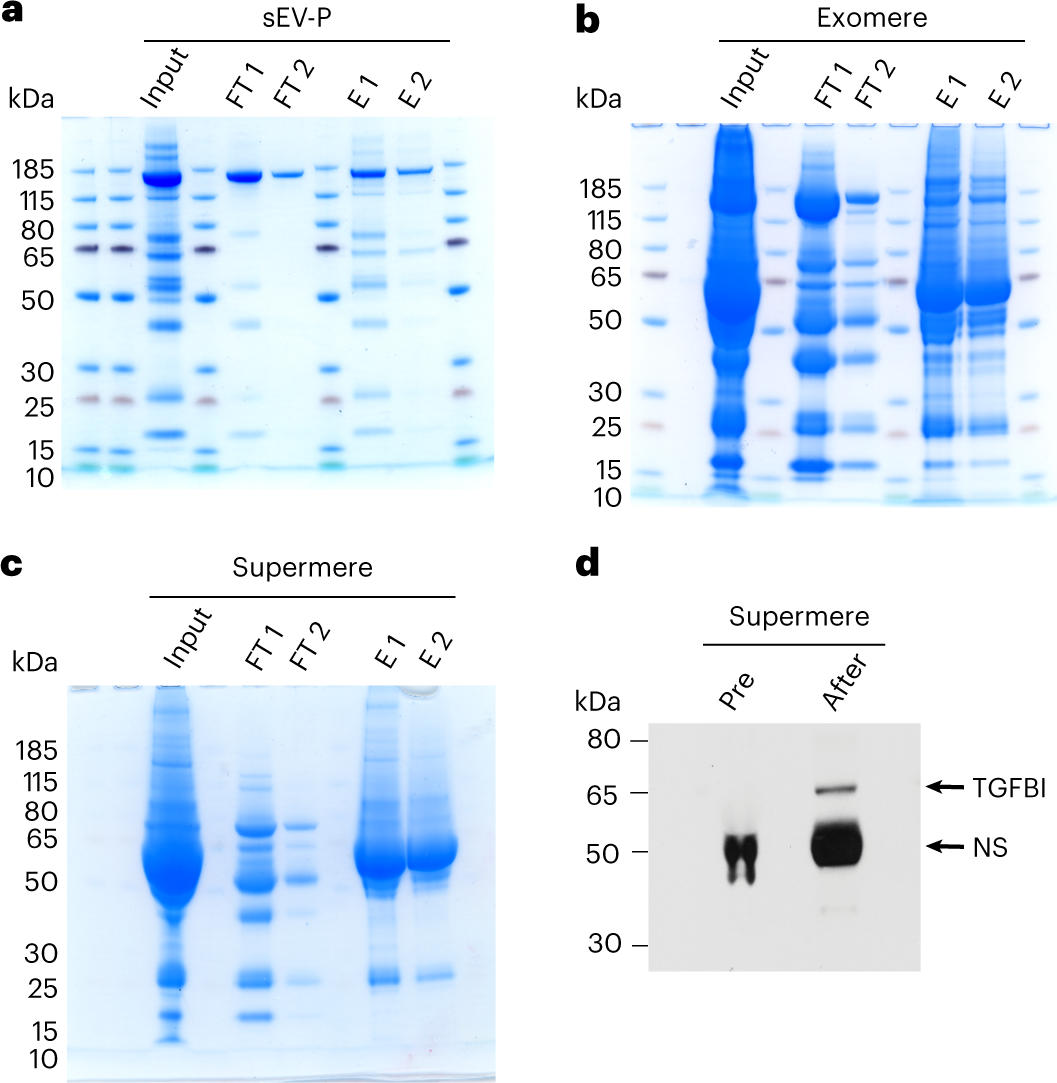 Fig. 7: Depletion of albumin from sEV-Ps, exomeres and supermeres isolated from plasma from patients with colorectal cancer.