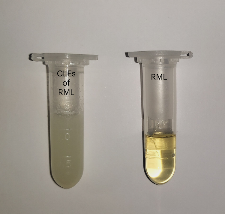 Fig. 8: The formation of CLEs of RML.