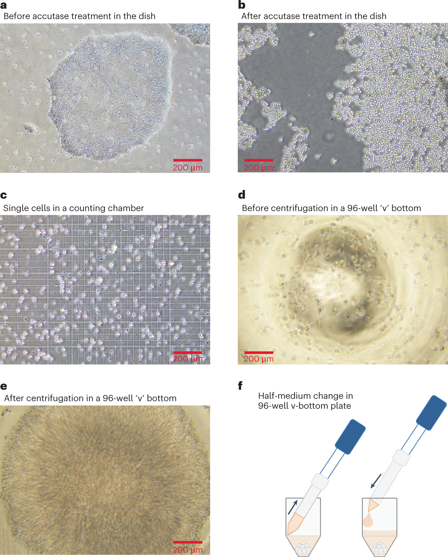 Fig. 2: Overview of preparing iPSCs for a successful differentiation into OVB organoids.