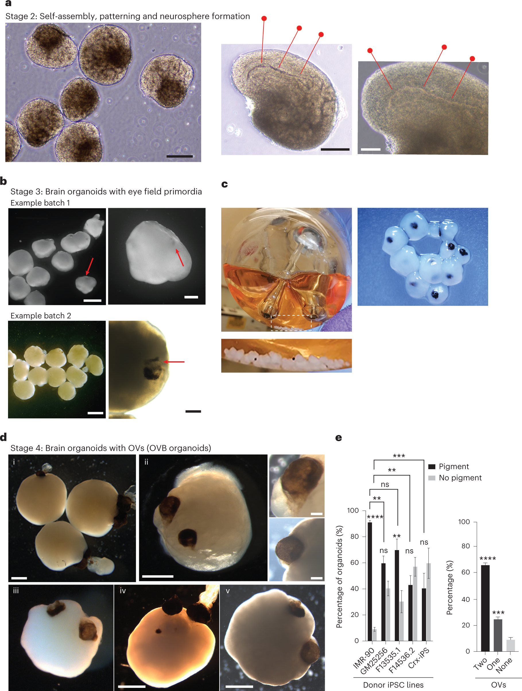 Fig. 3: Overview of OVB organoid generation stages and characterizations.