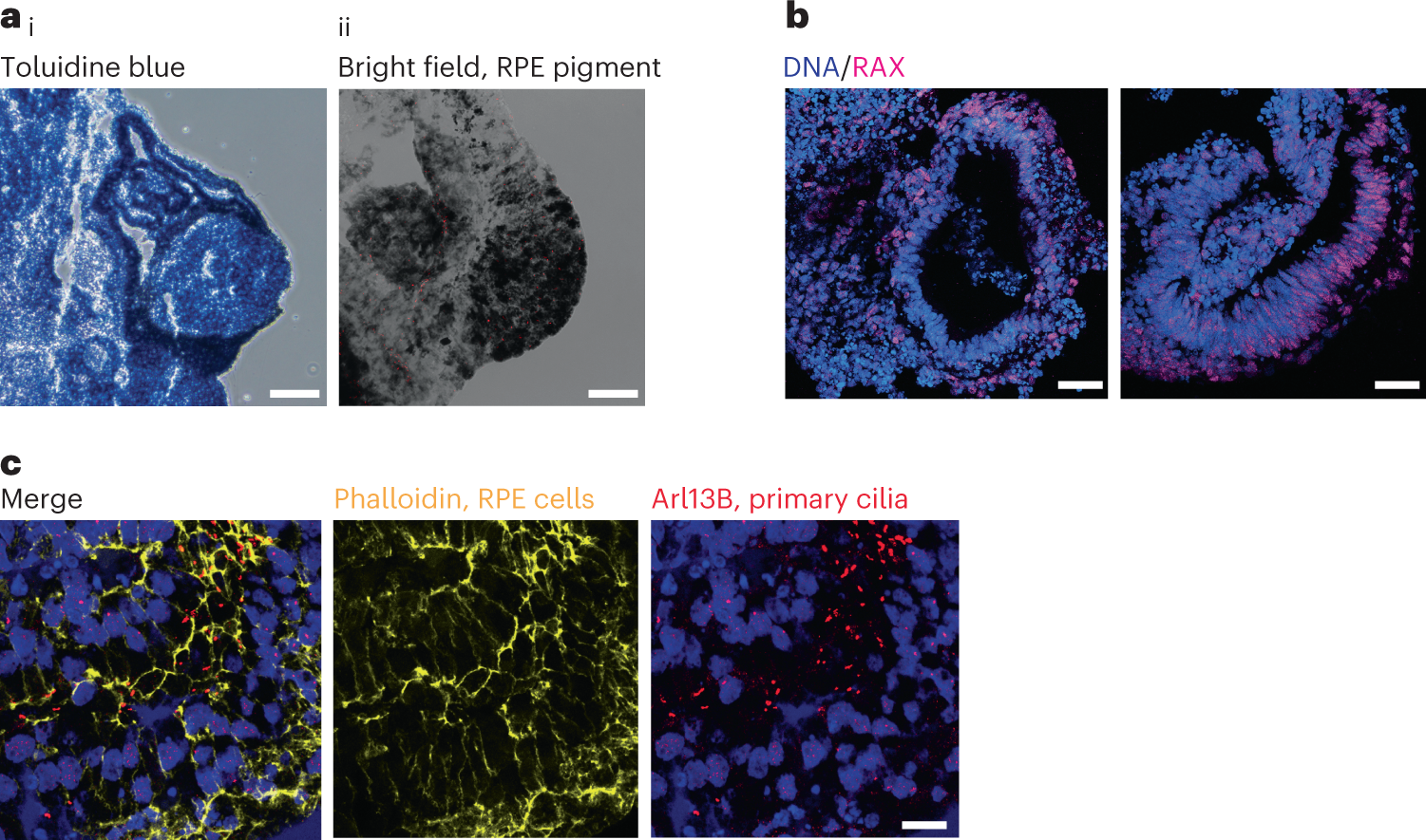Fig. 4: Initial characterization of OVB organoids.