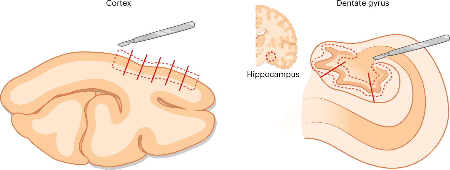 Fig. 2: Dissection of the cortex and hippocampus.