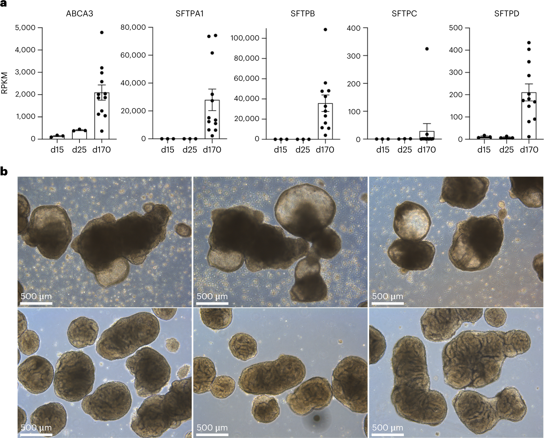 Fig. 3: Maturation of organoids and selection of suspension organoids for embedding.