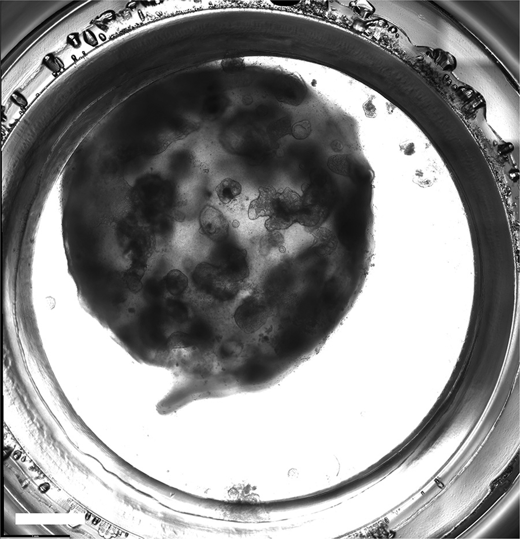 Fig. 4: Morphology of lung organoids embedded in Col I gel.