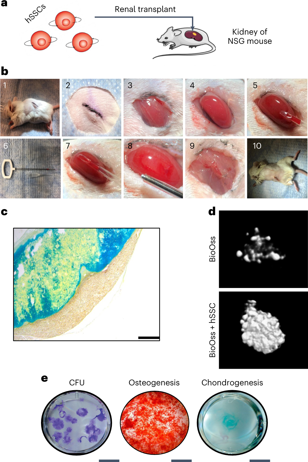 Fig. 4: Renal capsule xenograft model and in vitro skeletal differentiation assays.