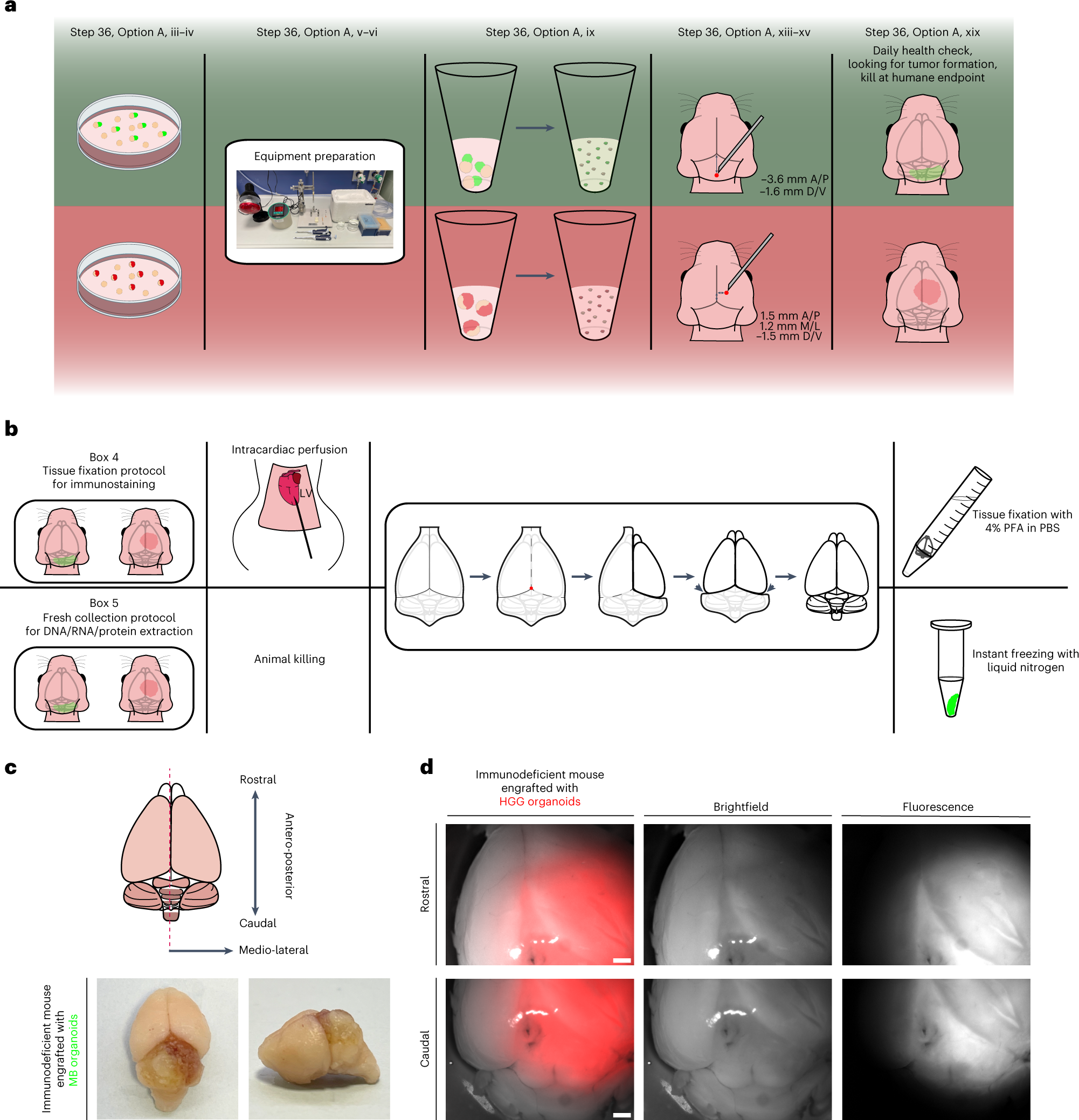 Fig. 3: Schematic workflow for MB and HGG organoid engraftment in immunodeficient mice and collection of grafted brain tissue.