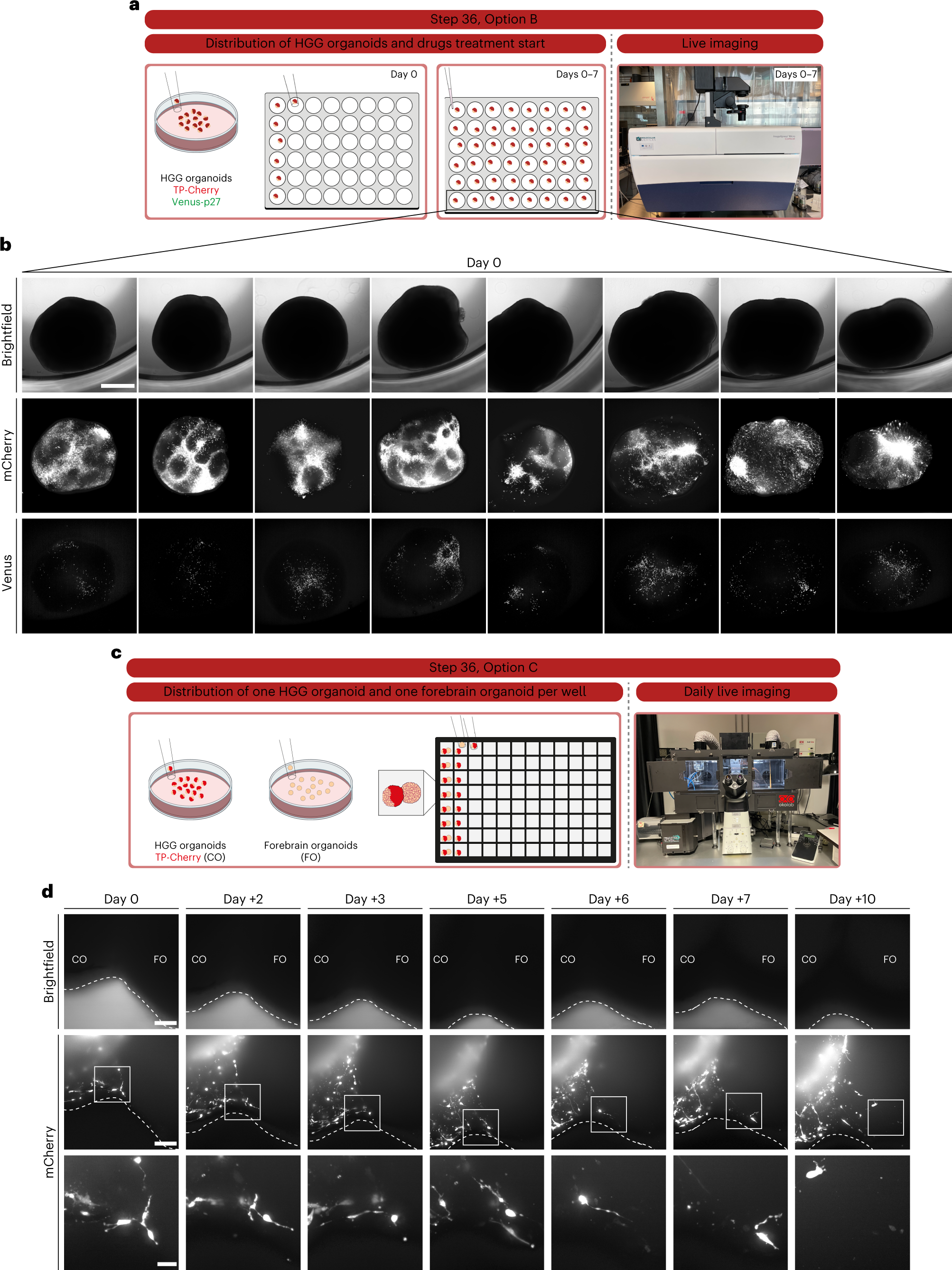 Fig. 4: Schematic workflow and representative images of HGG organoids downstream applications.