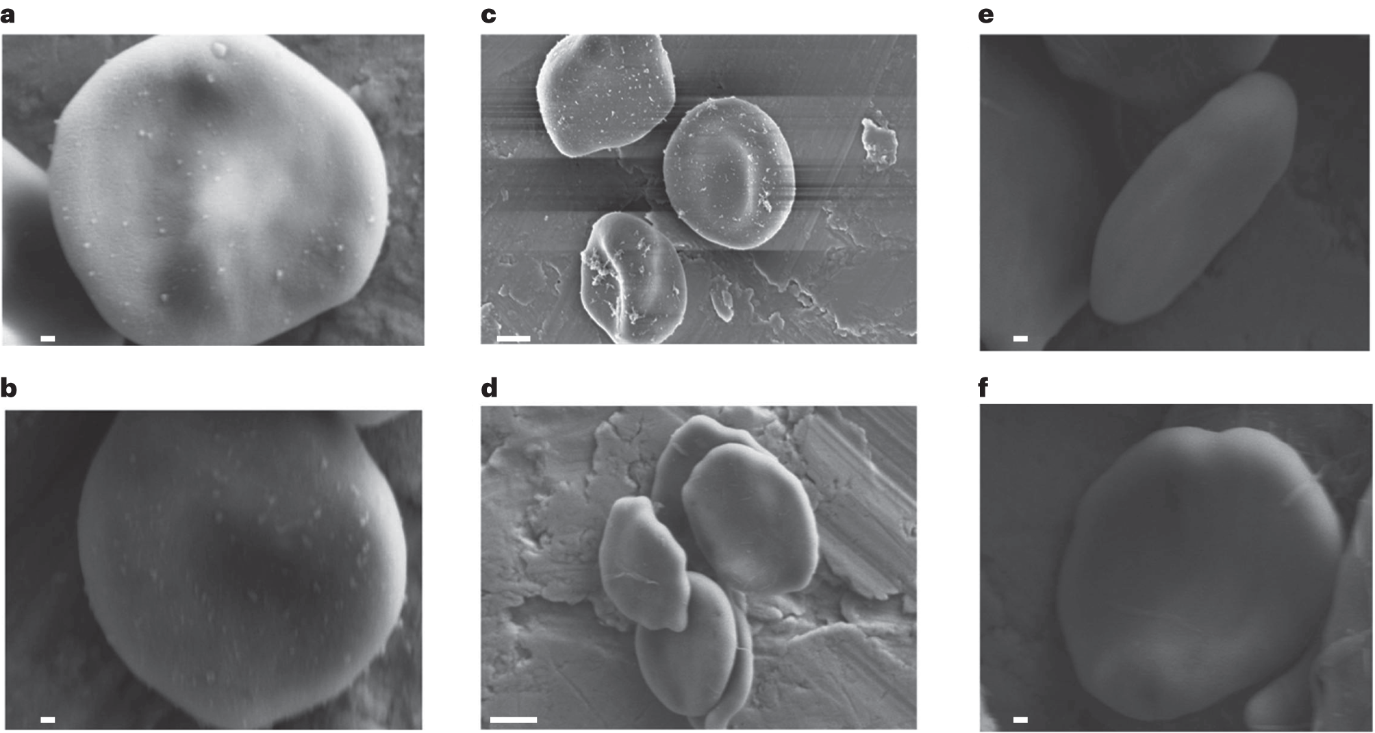 Fig. 12: Representative SEM visualization of IL-PLGA NP RBC hitchhiking in vitro.