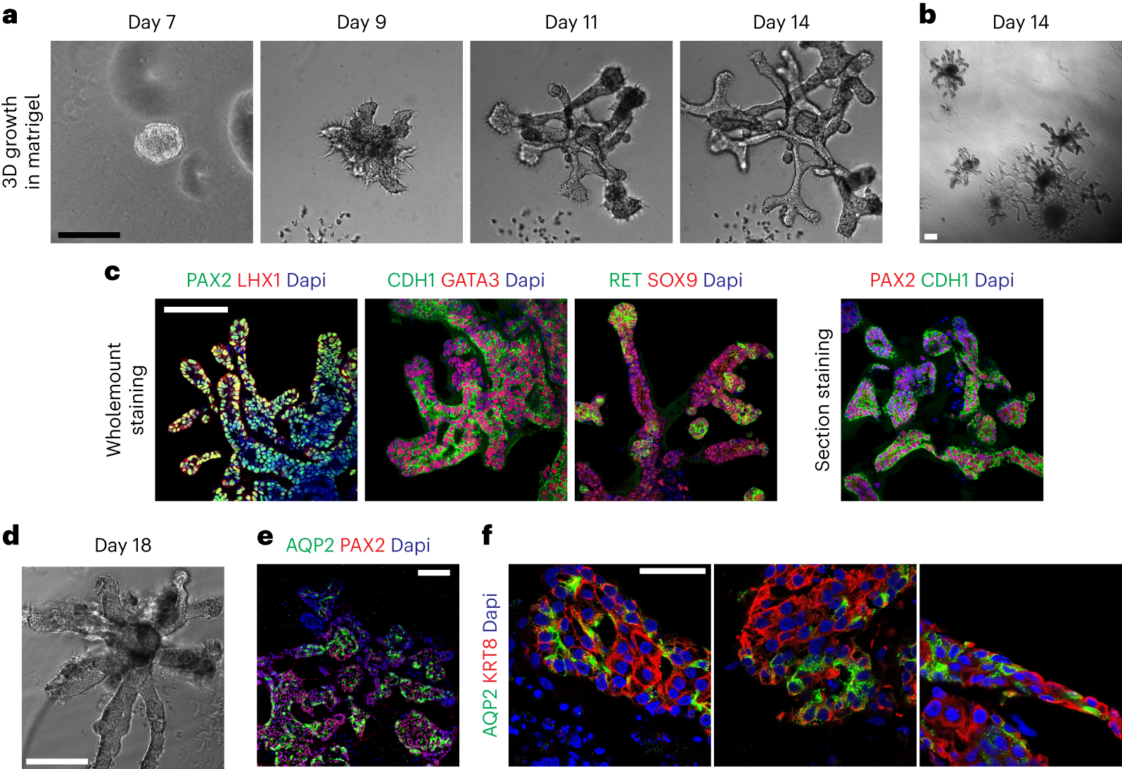 Fig. 5: Morphogenesis and differentiation of UB organoids in 3D culture.