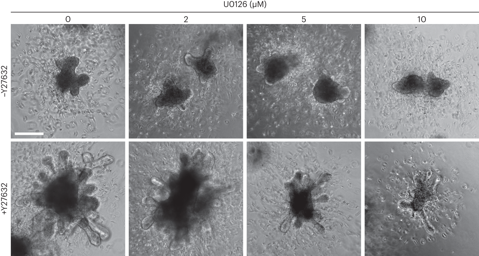 Fig. 6: Optimization of UB medium for branching in iPSC72-3-derived organoids.