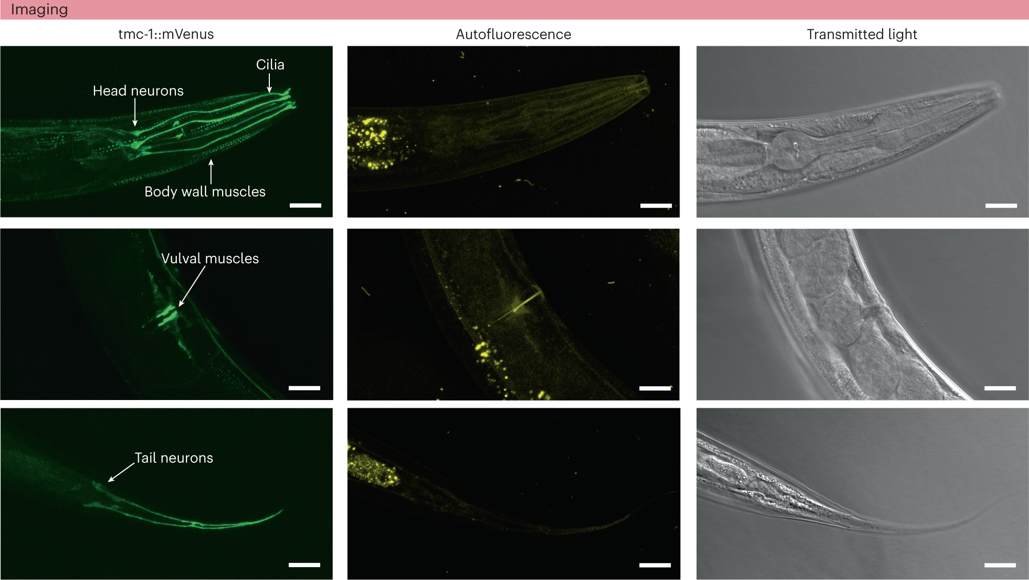 Fig. 3: Identifying regions of TMC-1–mVenus expression using spectral imaging and linear unmixing.