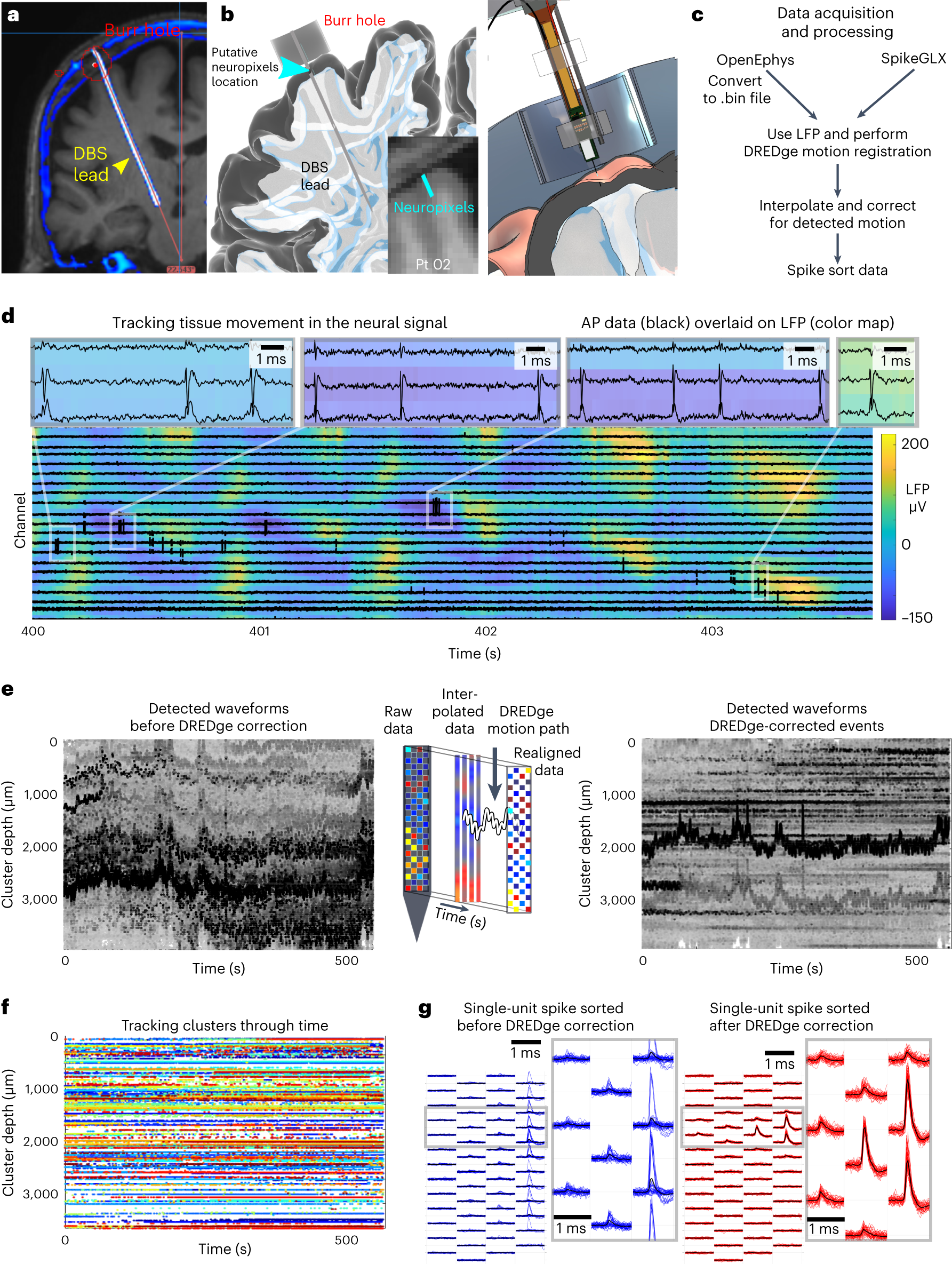 Fig. 7: Electrode localization and DREDge motion registration for eventual spike sorting and mapping to cortical layers.