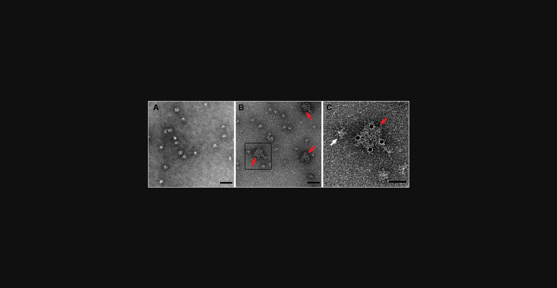 Details are in the caption following the image Immunoelectron microscopy of Flublok (Sanofi Pasteur), a commercially available influenza vaccine from 2017 to 2018 containing hemagglutinin from H1N1, H3N2, and influenza B viruses. (A) Negative stain of vaccine stained with 3% PTA. Scale bar, 100 nm. (B) Vaccine labeled for H1N1 hemagglutinin using polyclonal rabbit antibody and 10-nm gold-conjugated goat anti-rabbit antibody (Aurion). Note that the complexes are small enough that antibody binding appears to alter the size of the complex (red arrows), as the antibodies can also be visualized. Scale bar, 100 nm. (C) Enlarged region from panel B showing complex containing H1N1 hemagglutinin antigen with immunogold labels (red arrow) compared with an unlabeled complex lacking H1N1 hemagglutinin antigens (white arrow). Scale bar, 50 nm.