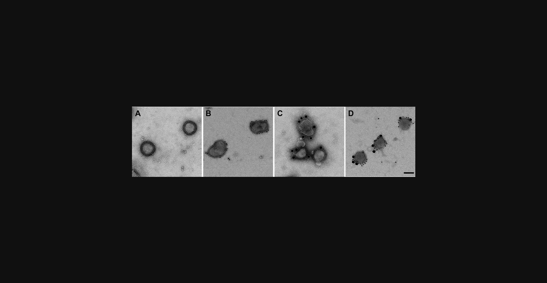 Details are in the caption following the image Immunoelectron microscopy of pandemic H1N1 influenza virus (A/California/04/09) produced in MDCK cells. (A) Negative stain of influenza virus stained with 3% PTA. (B) Virus labeled for hemagglutinin with C179 HA-stem binding antibody and 10-nm colloidal gold–conjugated goat anti-mouse antibody. (C) Virus labeled for neuraminidase with polyclonal rabbit antibody and 25-nm colloidal gold–conjugated goat anti-rabbit secondary antibody. (D) Virus double labeled for hemagglutinin (10-nm gold labels) and neuraminidase (25-nm gold labels). Scale bar, 100 nm.