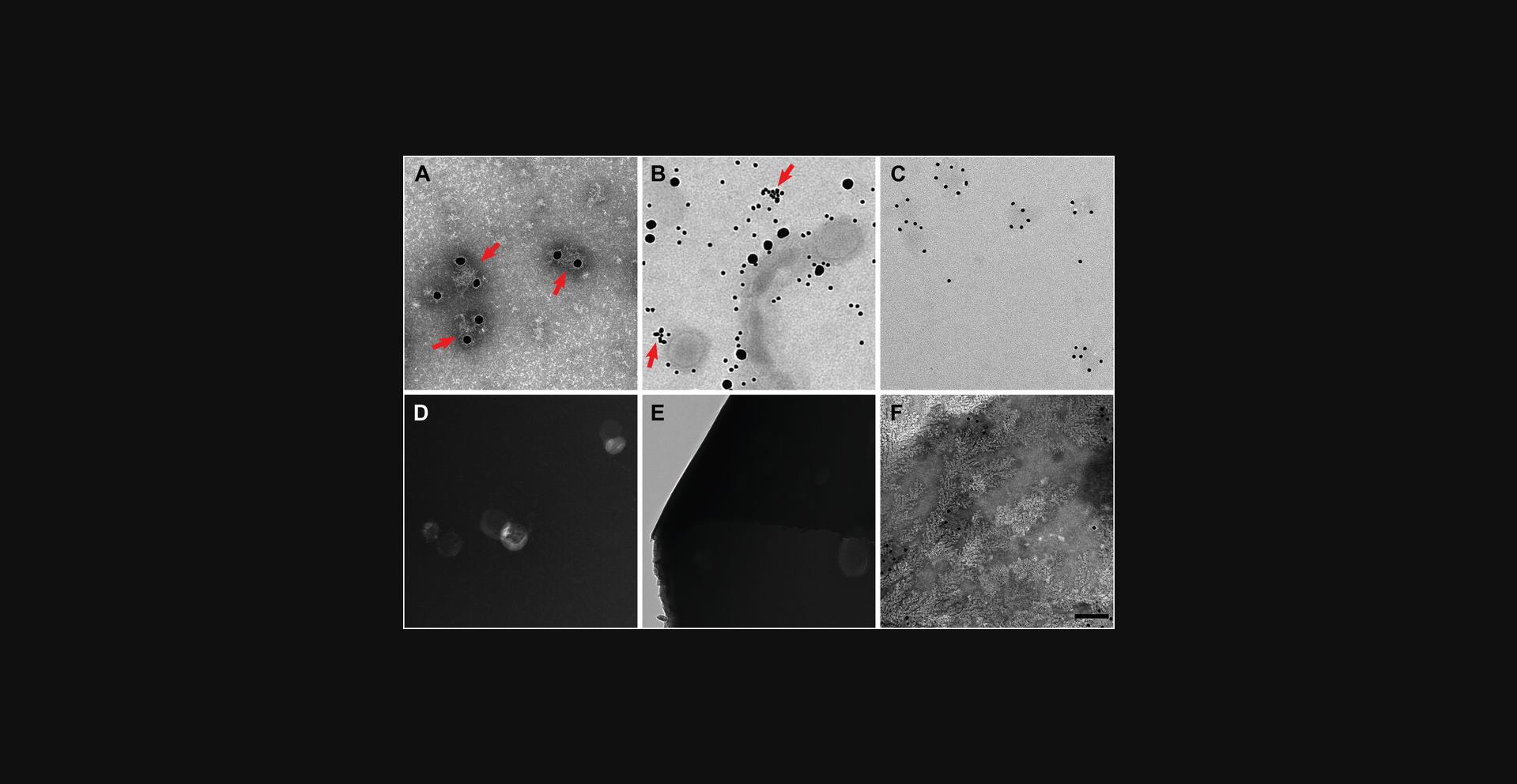Details are in the caption following the image Troubleshooting errors when preparing immunogold-labeled or negative-stained TEM grids. (A) 25-nm gold labels cannot fully label Flublok influenza vaccine antigens or fully surround the complexes compared with 10-nm gold-labels shown in Figure 1B, possibly due to steric hindrance from neighboring gold-labeled antibodies. Nevertheless, the labeled complexes appear larger because primary antibodies were successfully able to bind (red arrows). (B) Nonspecific background labeling of pandemic H1N1 influenza A virus prevents successful interpretation of antigen presence. Red arrows indicate antibody aggregates, which may also limit data interpretation. (C) Even in conditions of poor-contrast negative staining, the presence of Flublok antigens is evidenced by 10-nm gold-labeled H1N1 hemagglutinin. (D) Dense negative staining of pandemic H1N1 influenza A virus makes samples appear opaque; thus, interpretation of morphology is challenging. (E) Heavy staining can lead to broken carbon on the grid of pandemic influenza A virus. (F) Fractal-like artifacts due to interactions between phosphate-containing buffer and PTA negative staining solution make analysis of the Flublok sample challenging. Scale bar, 100 nm.