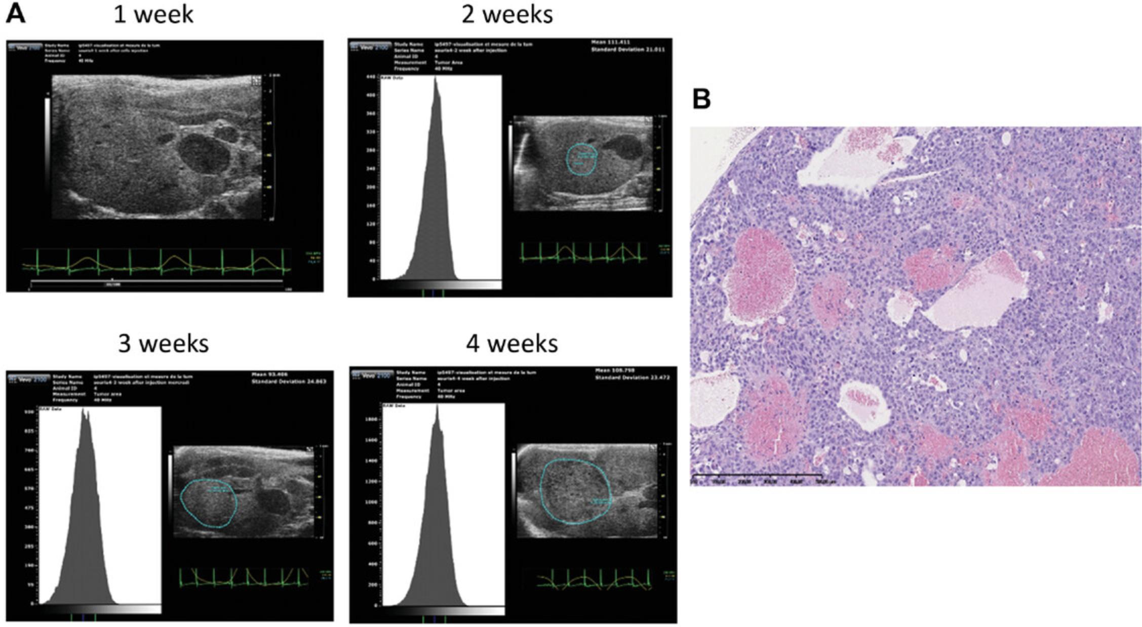 Details are in the caption following the image Longitudinal follow-up of tumor growth. (A) Tumor formation at 1, 2, 3, and 4 weeks after injection (2D area in blue) and histogram for the surrounding area representative of the pixel count. (B) Histological stain of the tumor.