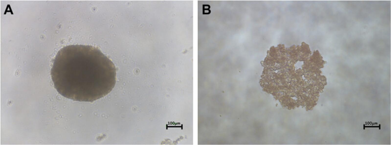 Details are in the caption following the image Morphology of spheroids produced using the liquid-overlay technique (LOT). (A) A phase-contrast image of a properly formed spheroid produced using 4000 PRH at day 3. (B) An example where a spheroid has failed to form correctly. Scale bar = 100 µm.