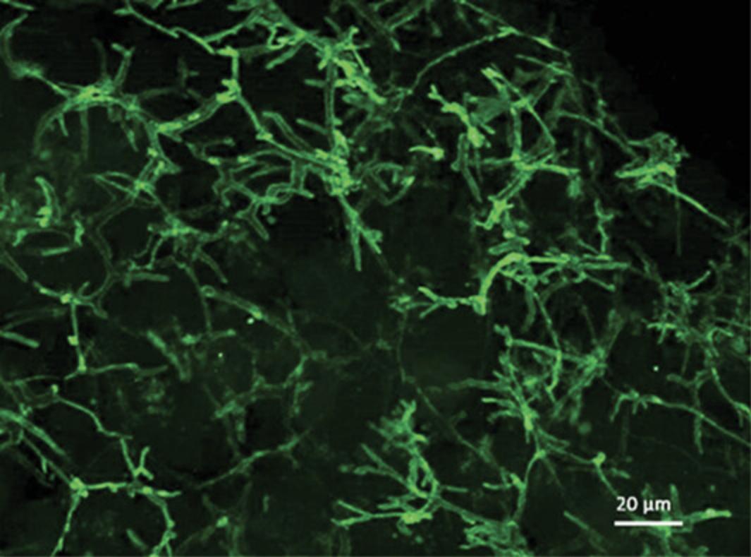 Details are in the caption following the image P-gp staining of bile canalicular formation throughout spheroids. 3000-cell spheroids were cultured on liquid-overlay plates for 3 days, fixed, and stained with P-gp (green). A maximum intensity projection image was taken at 40× magnification. Scale bar = 20 µm.