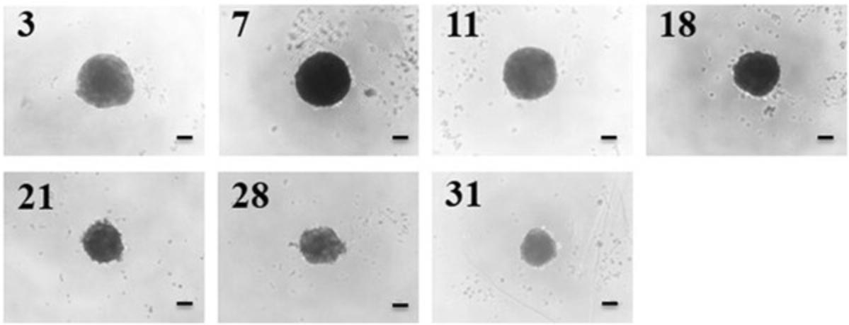 Details are in the caption following the image Compaction of 2000-cell spheroids over 31 days of culture. Phase-contrast images of spheroids were taken at days 3, 7, 11, 18, 21, 28, and 31 of the culture period. Scale bar = 100 µm.