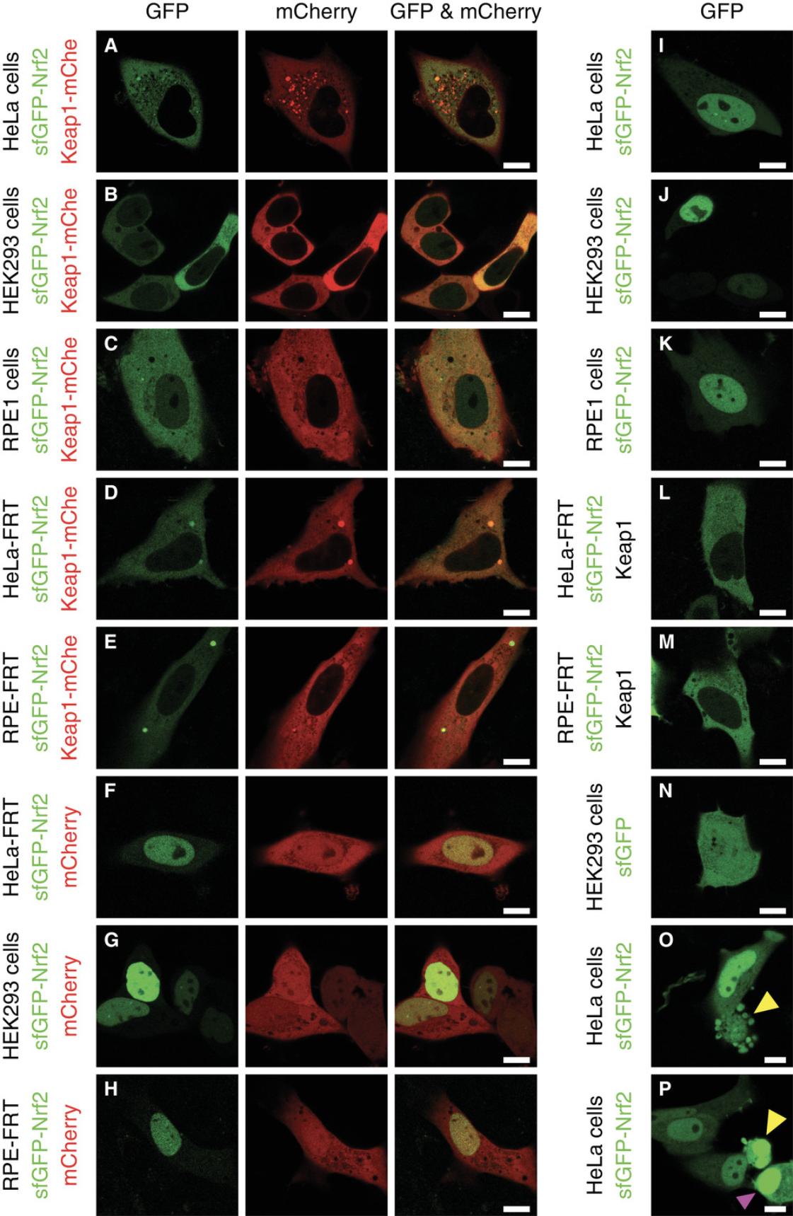 Details are in the caption following the image Representative images of cells expressing various combinations of fluorescent constructs used in the assay. Various cell types (A, I, O, P —HeLa cells; B, G, J, N—HEK293 cells; and C, K—RPE1 cells; as well as cells modified with FRT genomic integration site, D, F, L—Hela-FRT cells; and E, H, M—RPE-FRT cells) were transfected with sfGFP-Nrf2 and/or other indicated plasmids as described in Basic Protocol 1 or Alternate Protocol 1 and imaged in the green channel suitable for sfGFP and the red channel suitable for mCherry using confocal microscopy. In cells expressing both fluorophores (A-H), the left panel shows sfGFP, the middle panel shows mCherry, and the right panel shows their overlay. Typically, sfGFP-Nrf2 is diffuse, with non-frequent speckles, and localizes predominantly—though not exclusively—to the cytoplasm when co-expressed with labeled (A-E) or unlabeled (L-M) Keap1. In this combination, the expression level of sfGFP-Nrf2 is usually low, due to its Keap1-dependent degradation. Keap1-12 fl-mCherry (Keap1-mChe, middle panels in A-E) is cytoplasmic in most cells, and could be either diffuse or aggregated. When expressed on its own (I-K, O-P) or together with free mCherry (F-H), sfGFP-Nrf2 is predominantly nuclear, and free sfGFP (N) is localized throughout entire cell, as well as free mCherry (F-H, middle panels). Cells undergoing or approaching cell death (O, P, yellow arrowhead) can be morphologically recognized by membrane blebbing (O) and/or nuclear condensation (P). When choosing cells for FLIM measurements, such cells should be avoided, as well as cells with excessive sfGFP fluorescence (P, purple arrowhead). Size bar is 10 µm. Images were assembled using OMERO. figure.