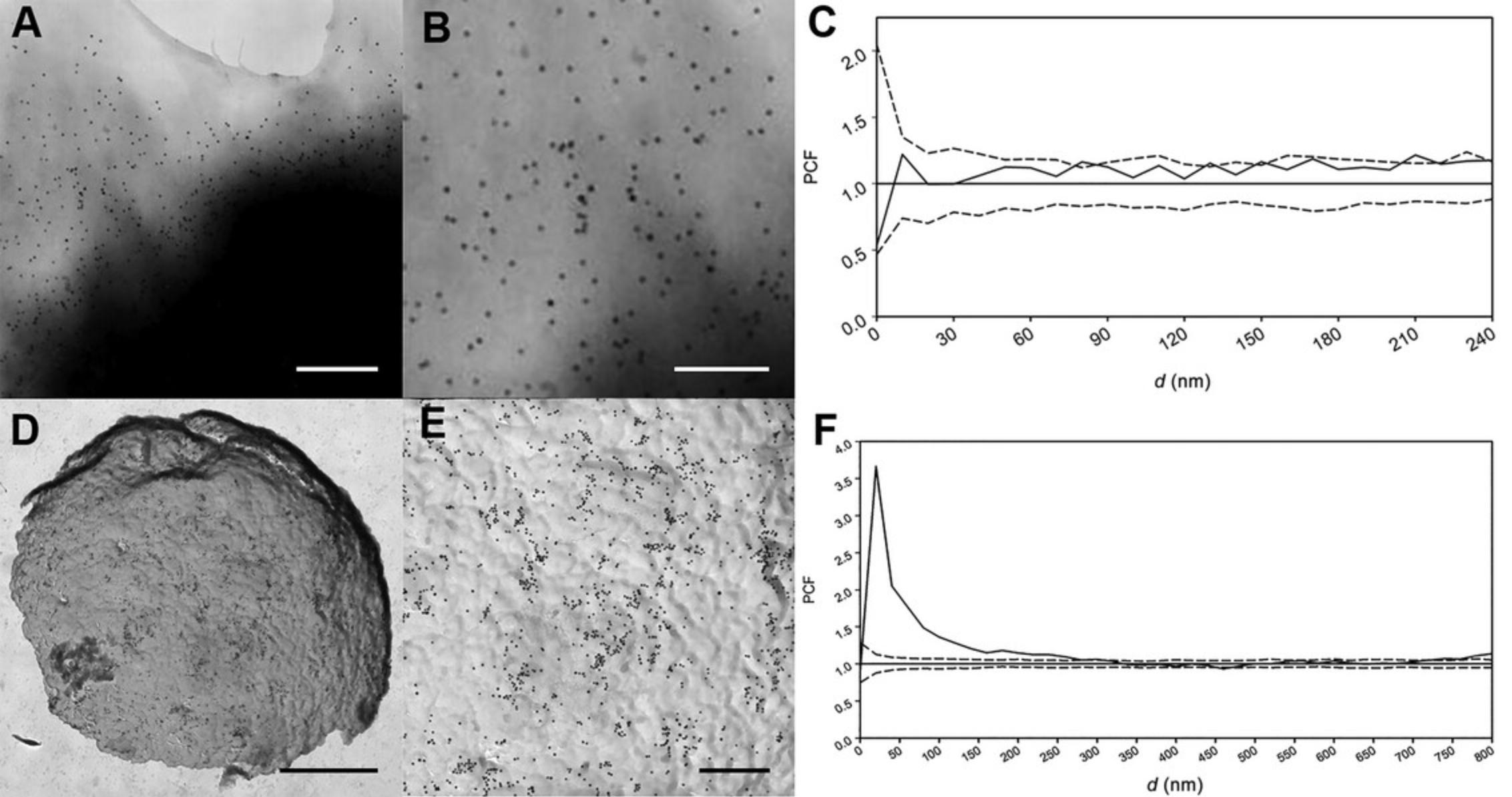 Details are in the caption following the image Differences between the results obtained by the traditional and new protocols. (A and B) Kv1.3/FLAG channels labeled with 10-nm gold beads on the CTLL-2 cell line (Panyi et al., 2003). (C) Pair correlation function (PCF) from the cropped image B. The diameter (d) of the clusters (in nanometers) is plotted on the abscissa. The PCF function is labeled with a solid line and the upper and lower confidence intervals with dashed lines. (D and E) Major histocompatibility complex class II (MHCII) molecules labeled with 20-nm gold beads on JY cell lines. (F) PCF from the cropped image E (details as in B). Scale bars: (A), 400 nm; (B), 200 nm; (D), 1500 nm; (E), 400 nm.