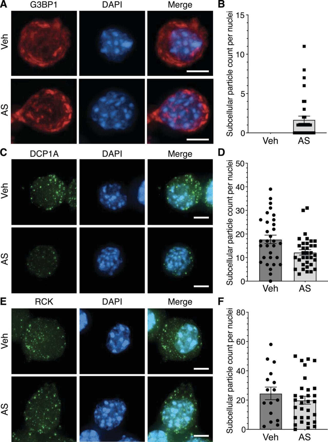 Details are in the caption following the image Immunofluorescence microscopy and automated quantification of mRNP granules. Primary myoblasts were treated with 0.125 mM sodium arsenite (SA) or vehicle (Veh) for 1 hr and immunostained for G3BP1 (A), DCP1A (C), and RCK (E), as outlined in Basic Protocol 1. Fluorescent microscopy Z-stacks were taken and deconvolved, and maximum intensity images were generated (Basic Protocol 2), for which representative images are shown. The number of mRNP granules was then quantified using CellProfiler. The numbers of G3BP1-, DCP1A-, and RCK-positive subcellular particles per cell are shown in panels (B), (D), and (F), respectively. Scale bar represents 2 µm.