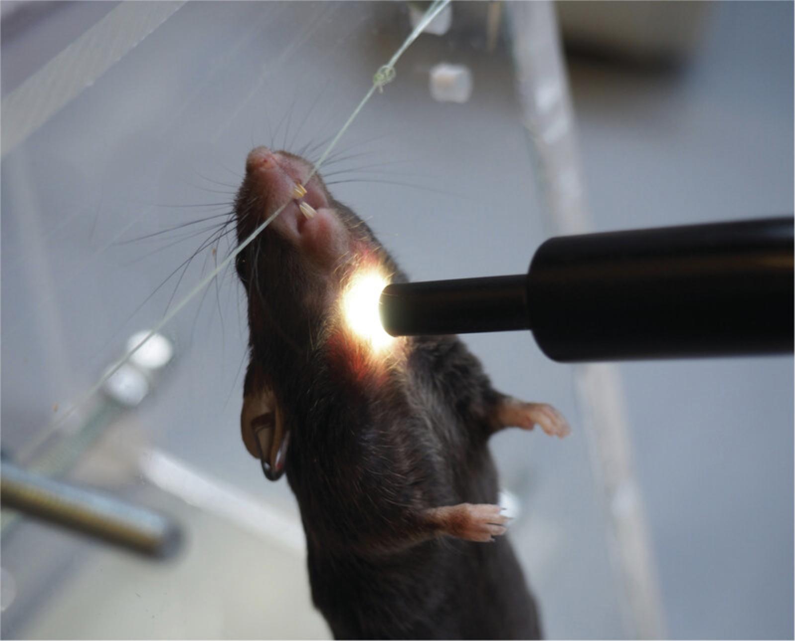 Details are in the caption following the image Correct positioning of light source for windpipe illumination.