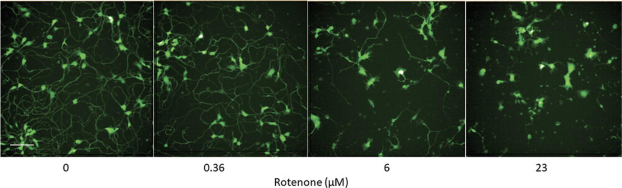 Details are in the caption following the image Representative images of cortical neurons treated with rotenone. Neurons in PDL-coated 1536-well plates were treated with different concentrations (0, 0.36, 6, and 23 μM) for 48 hr at 37°C, 5% CO<sub>2</sub>. Image is one field, 20× water objective, confocal mode. Scale bar: 100 μm.