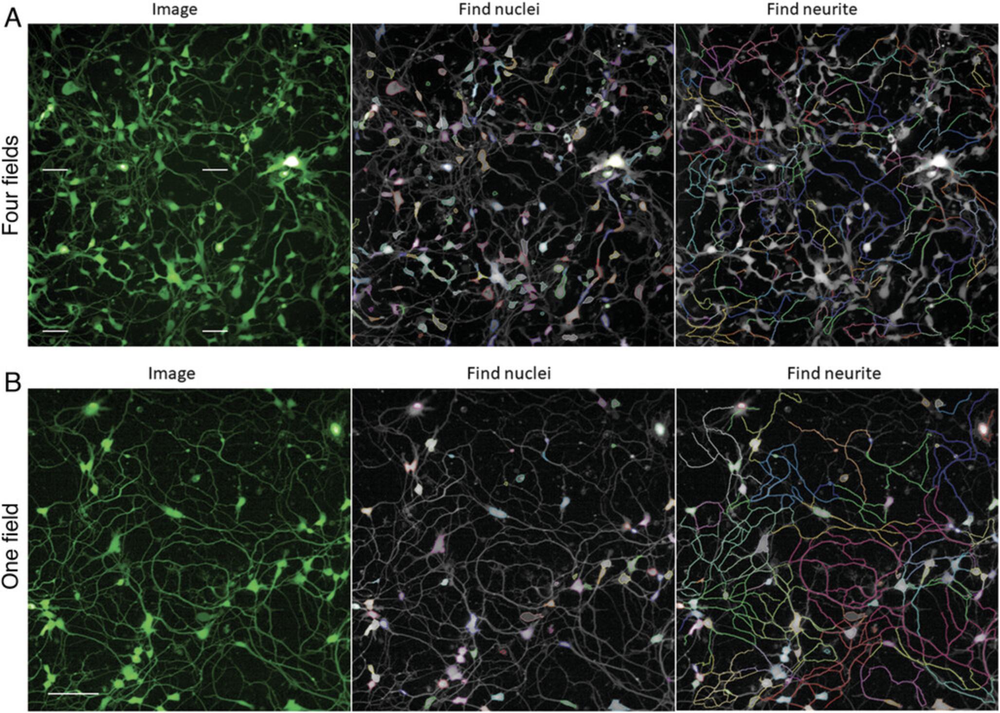 Details are in the caption following the image Examples of four-field and one-field image analysis of neurite outgrowth. Cortical neurons were imaged 90 hr post seeding. Left panels show acquisition from four fields (A) versus one field (B) from a well of a 1536-well plate. Middle and right panels show steps for finding cell bodies (nuclei) and finding neurites. All images acquired using a 20× water objective and confocal mode. Scale bar: 100 μm.