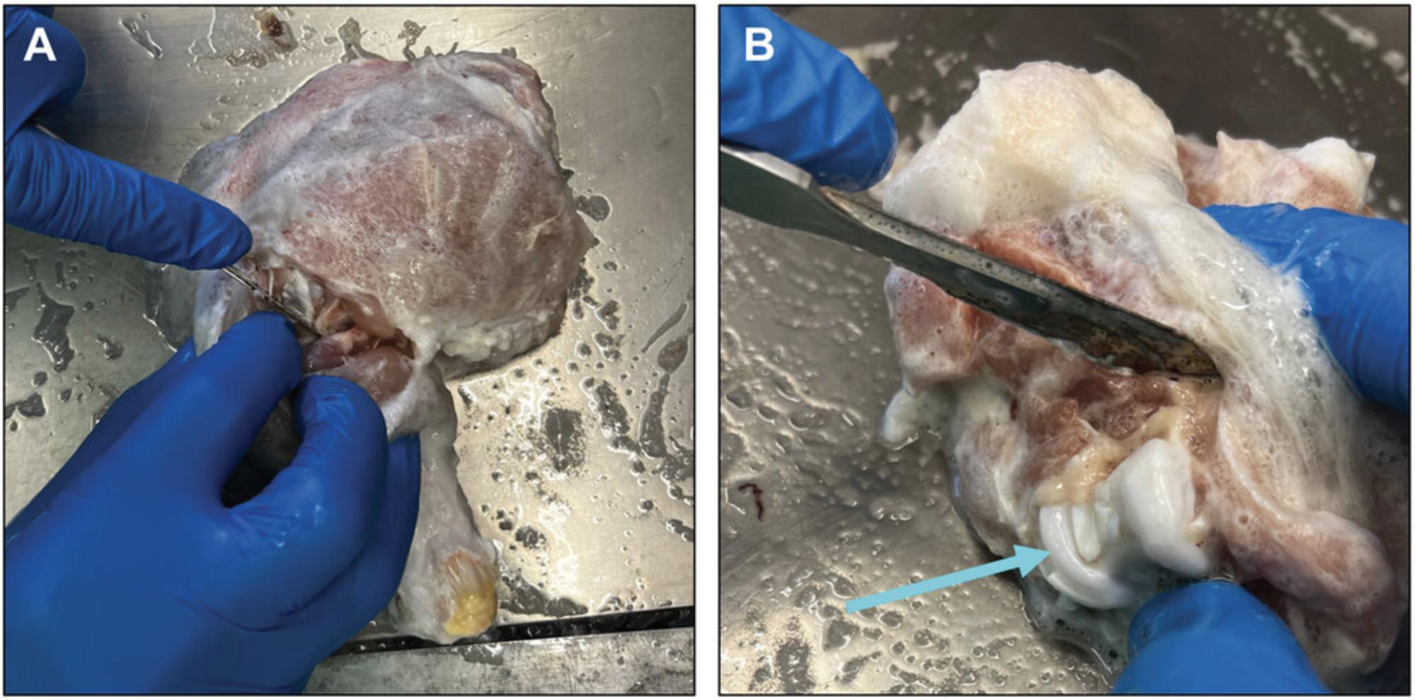 Details are in the caption following the image Dissection of chicken thigh for harvesting of articular cartilage shavings from the knee joint. (A) The isolated chicken thigh after a thorough cleaning. This photo shows the thigh after the feathery skin has been dissected away and being rinsed in 3% H<sub>2</sub>O<sub>2</sub>. (B) The knee joint has been opened with a scalpel from the ventral side following skin dissection. Shavings can be cut from articular surfaces of the femur (arrow) and tibia.