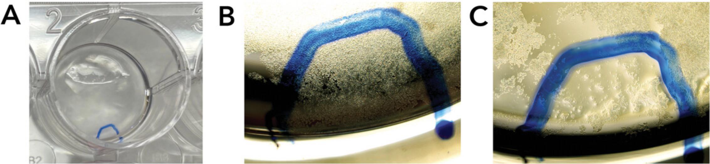 Optimized subcloning procedure. (<b>A</b>) Low magnification image of a 24-well showing a selected marked area corresponding to 1-2 iPSC colonies to be transferred during subcloning. (<b>B</b>) Phase contrast image at 2× magnification of the selected area during EDTA incubation. (<b>C</b>) Phase contrast image at 2× magnification of the selected area upon effective transfer to the new well.