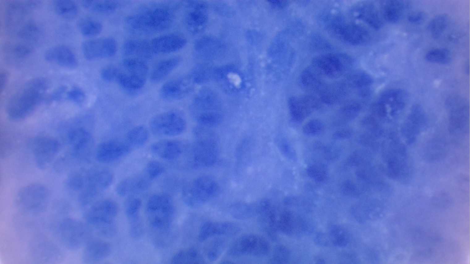 Figure 1. Part of an FFPE mouse brain tumor 10 µm shard after needle dispersion and 90 °C pre-treatments, stained with Trypan blue. Figure 1. Part of an FFPE mouse brain tumor 10 µm shard after needle dispersion and 90 °C pre-treatments, stained with Trypan blue.