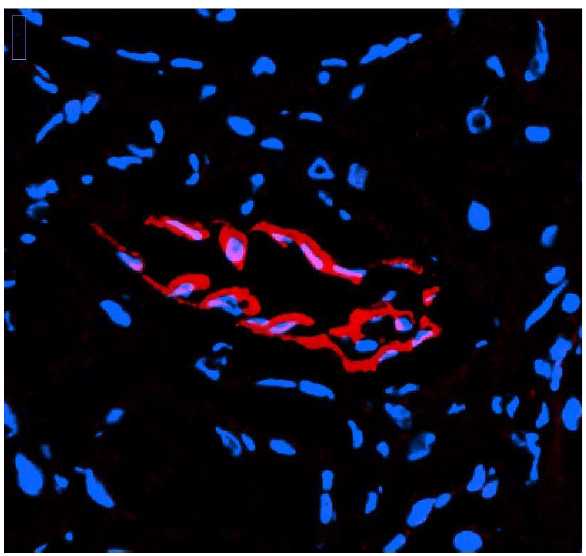 Aquaporin1 can be easily gated by setting intensity threshold as there is no background noise and robust signal Aquaporin1 can be easily gated by setting intensity threshold as there is no background noise and robust signal